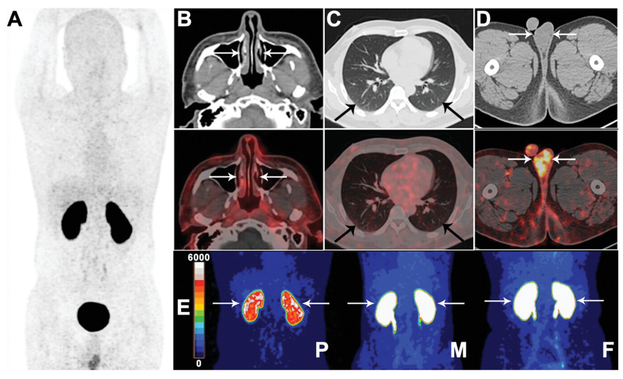 Ijms 25 09419 g006 Ijms 25 09419 g006