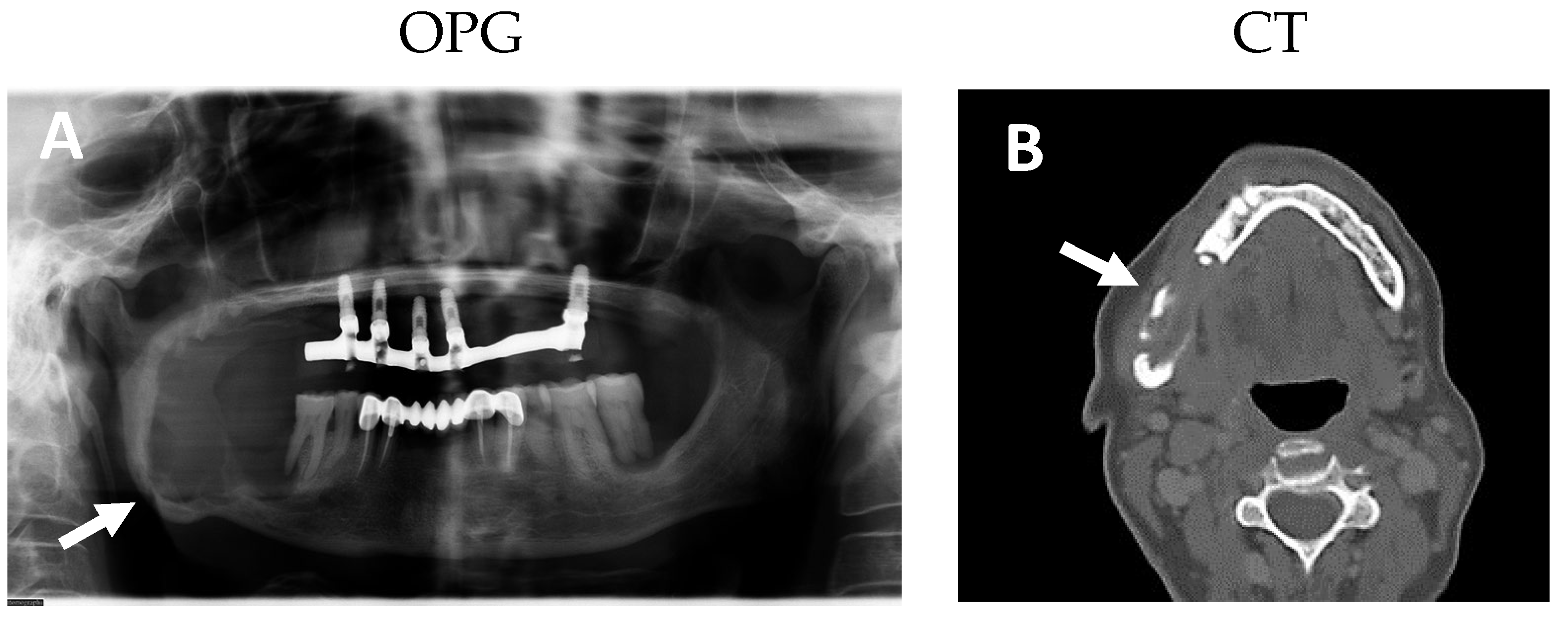 Ijms 25 09547 g001 Ijms 25 09547 g001