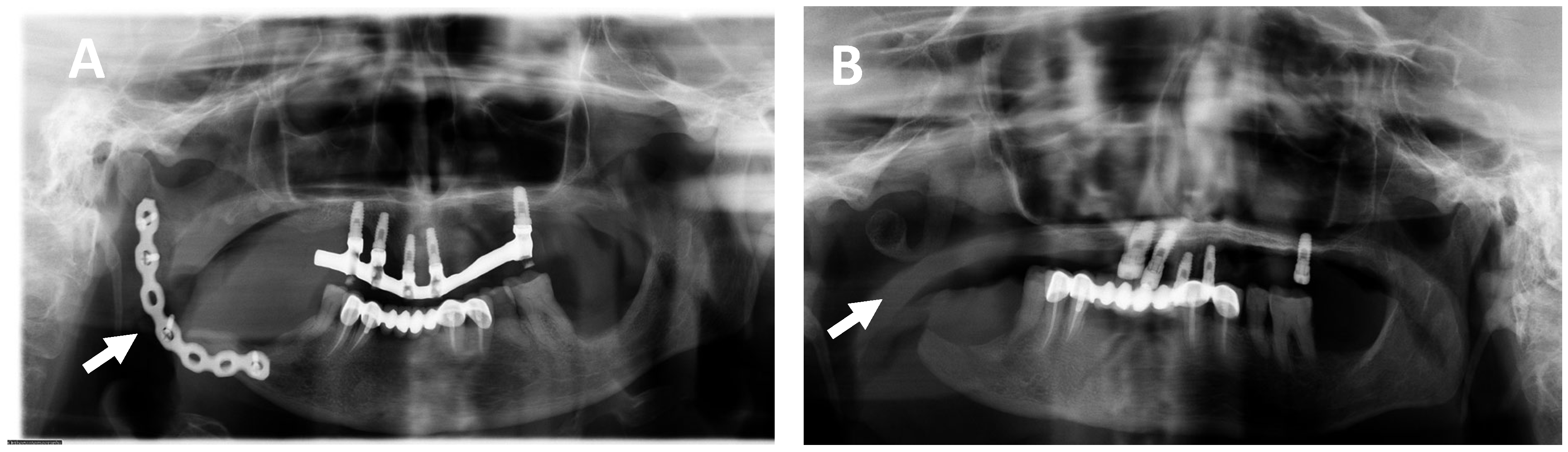 Ijms 25 09547 g004 Ijms 25 09547 g004