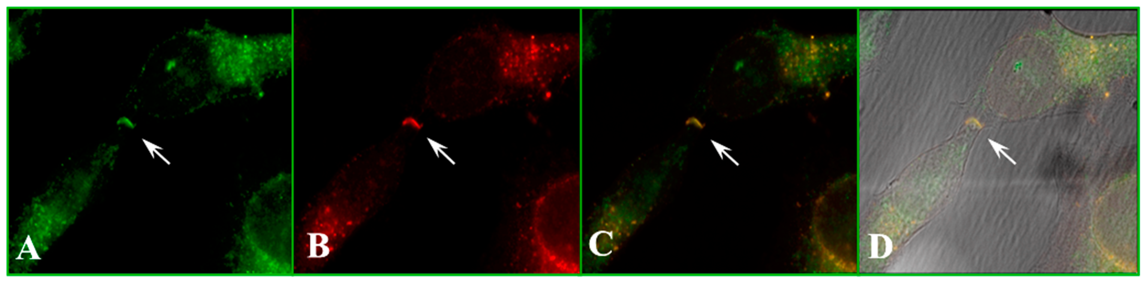 Ijms 25 09789 g011 Ijms 25 09789 g011