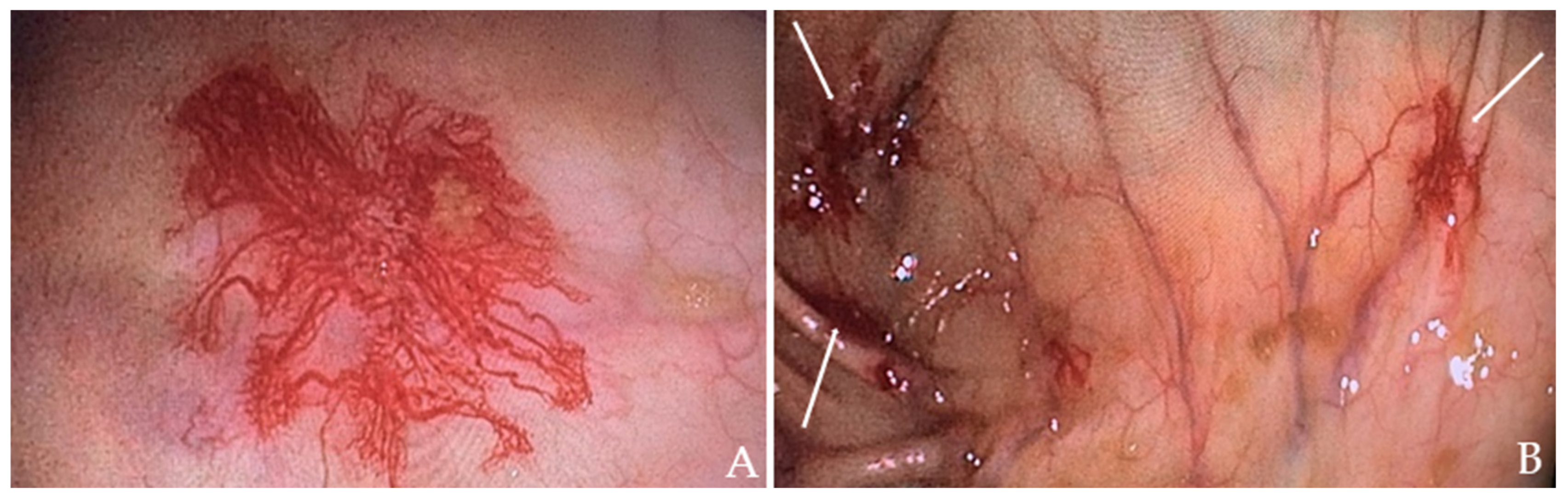 Ijms 25 11041 g002 Ijms 25 11041 g002