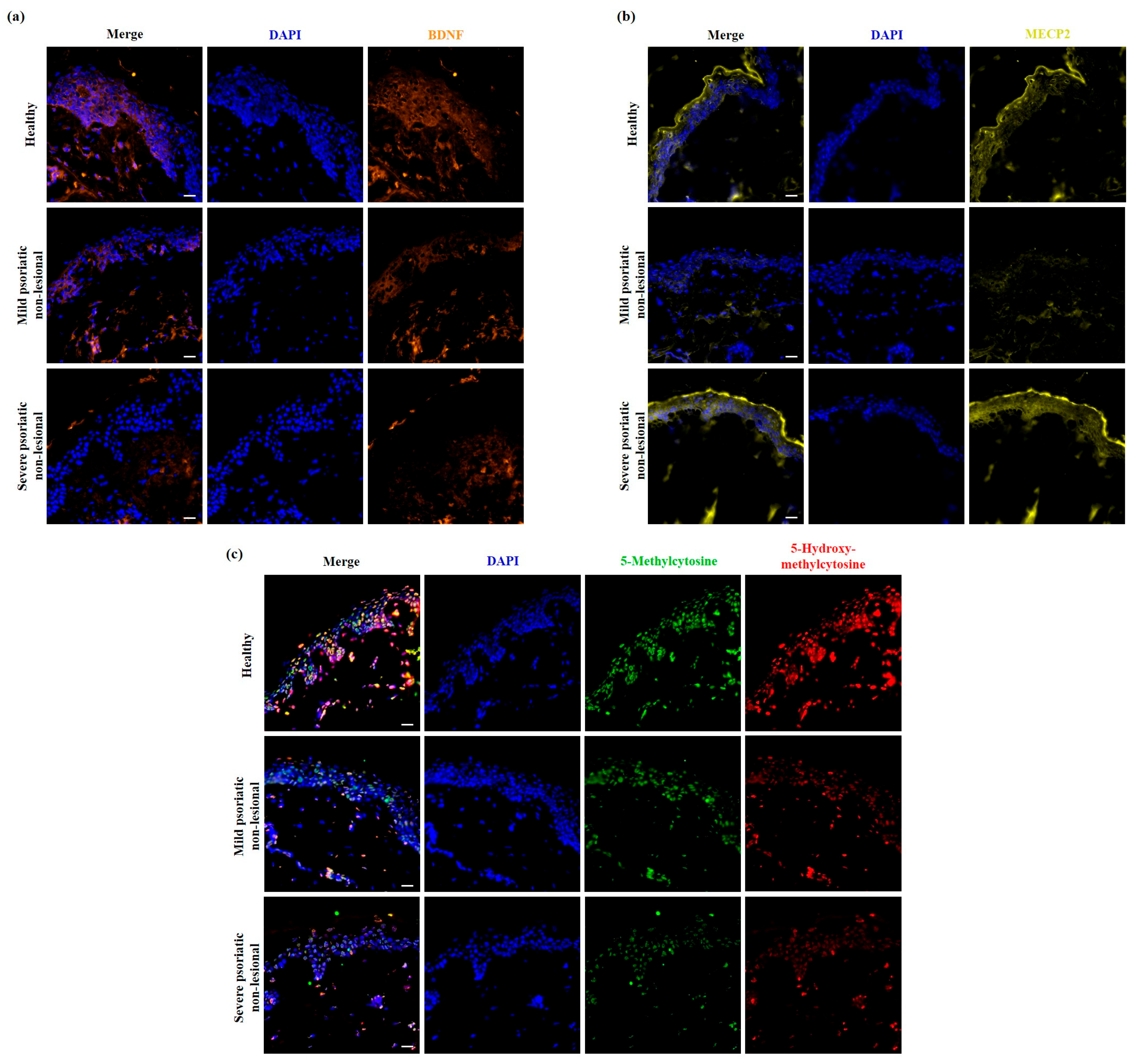Ijms 25 11292 g004 Ijms 25 11292 g004