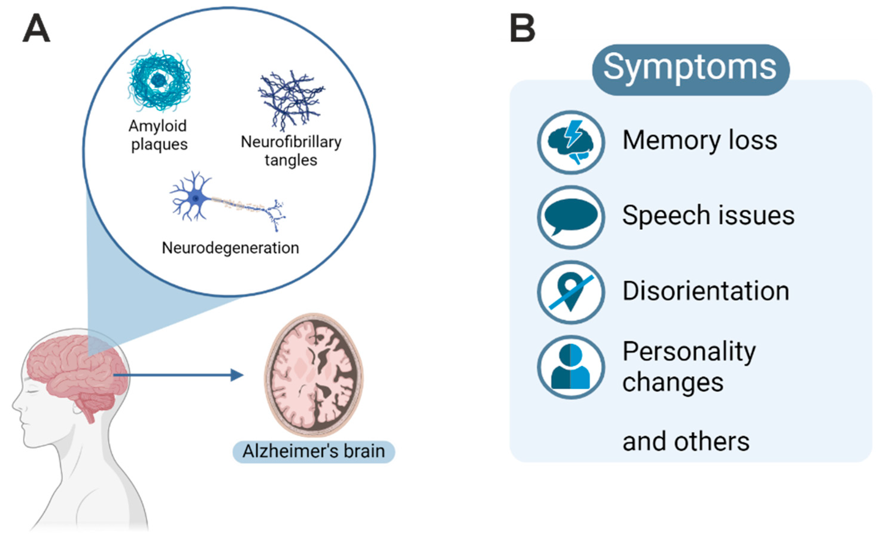 NF kappa B in Alzheimer rsquo s Disease Friend or Foe Opposite  