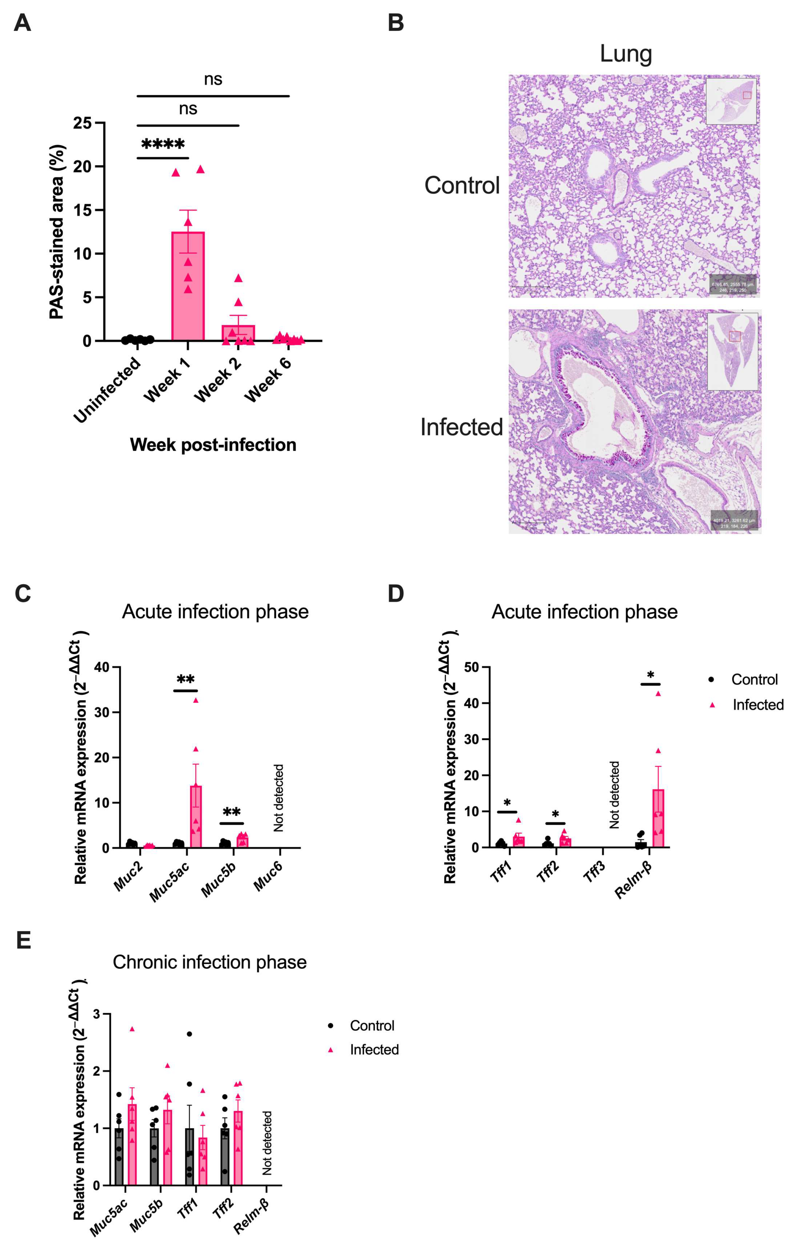 A Small Intestinal Helminth Infection Alters Colonic Mucus and  