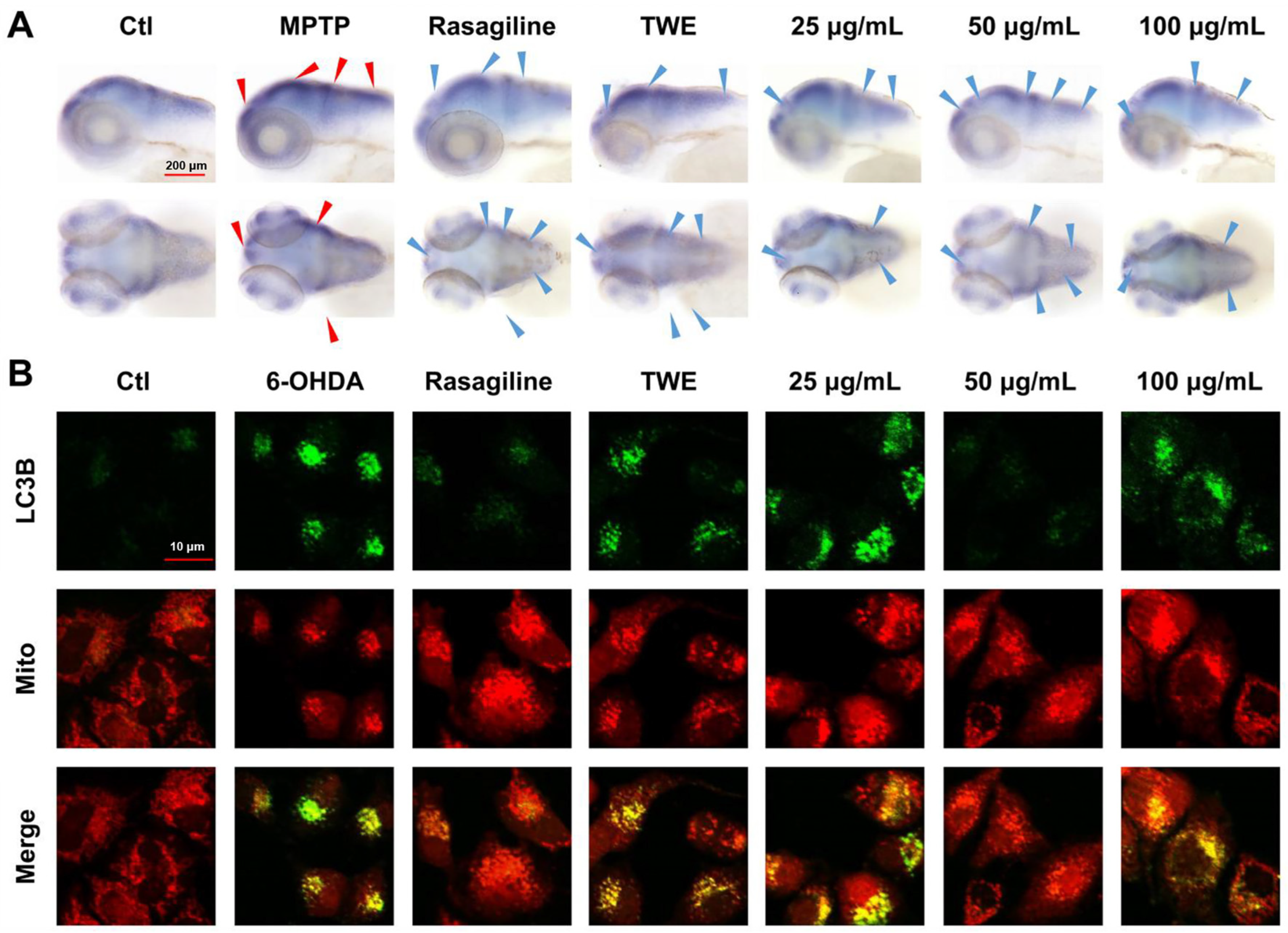 Ijms 26 02762 g005 Ijms 26 02762 g005