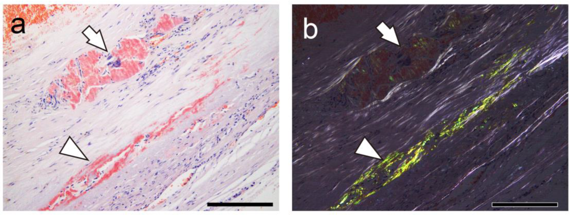 Ijms 26 04505 g004
