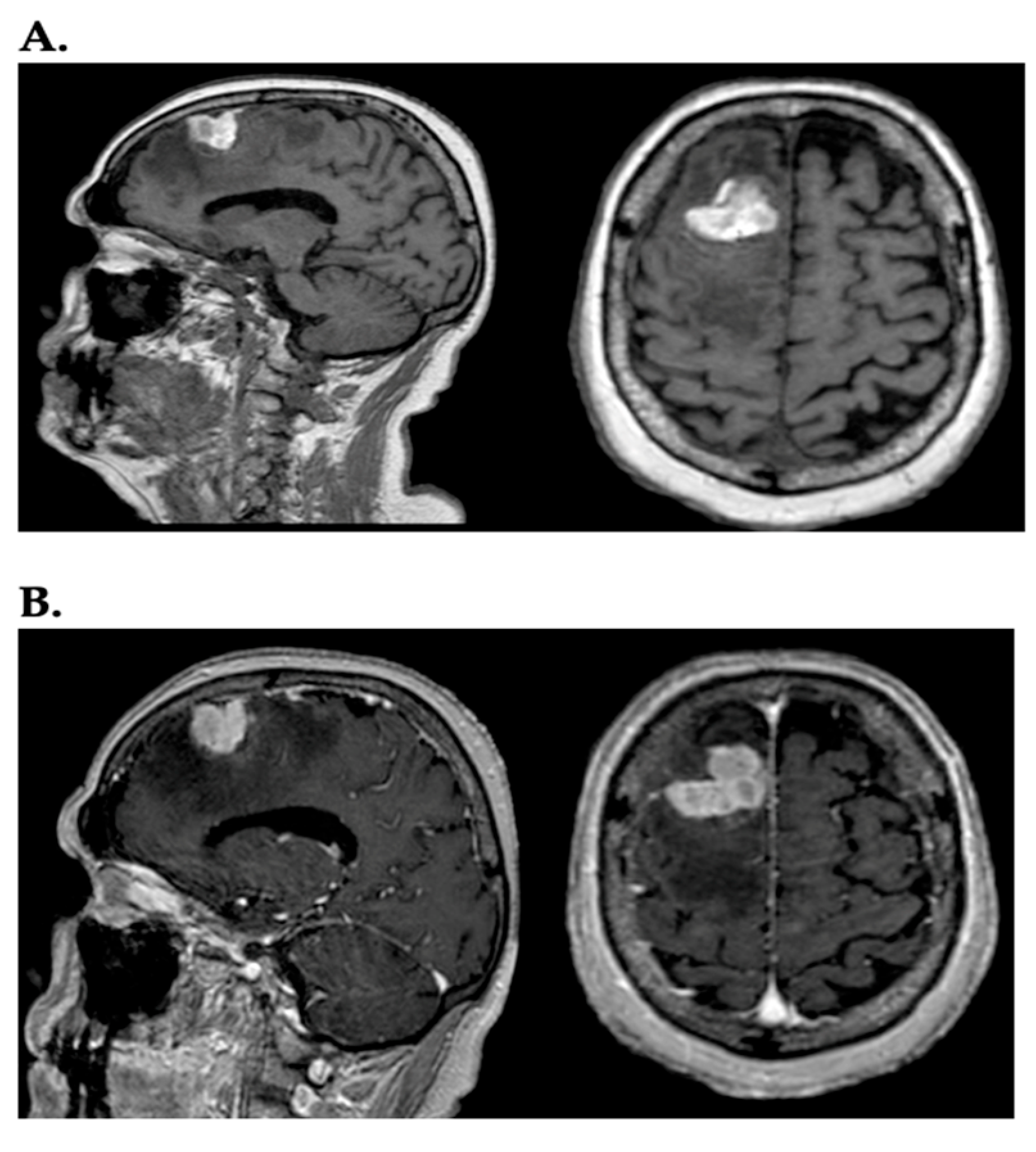Ijms 26 05018 g001