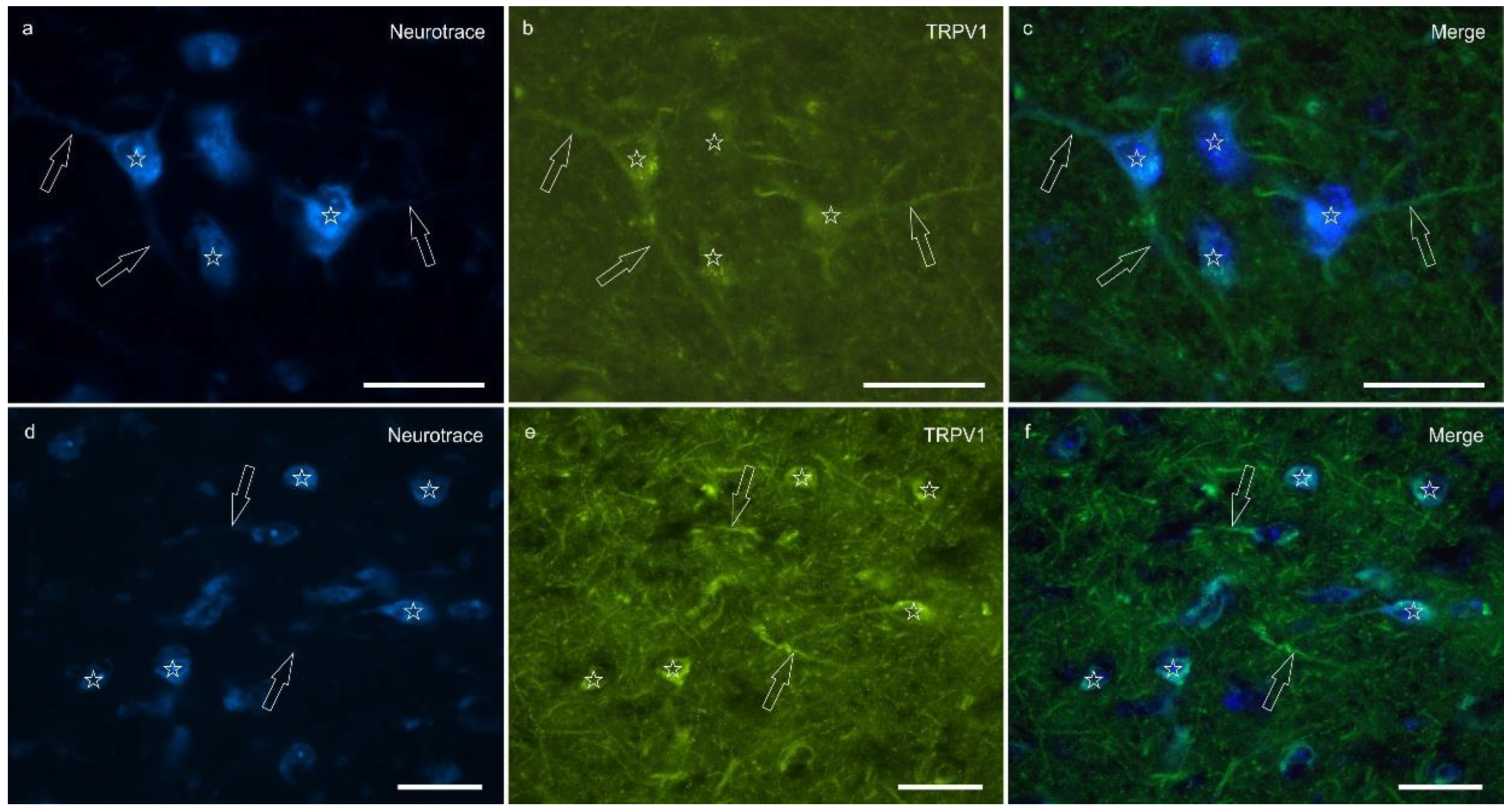 Ijms 26 07613 g004 Ijms 26 07613 g004