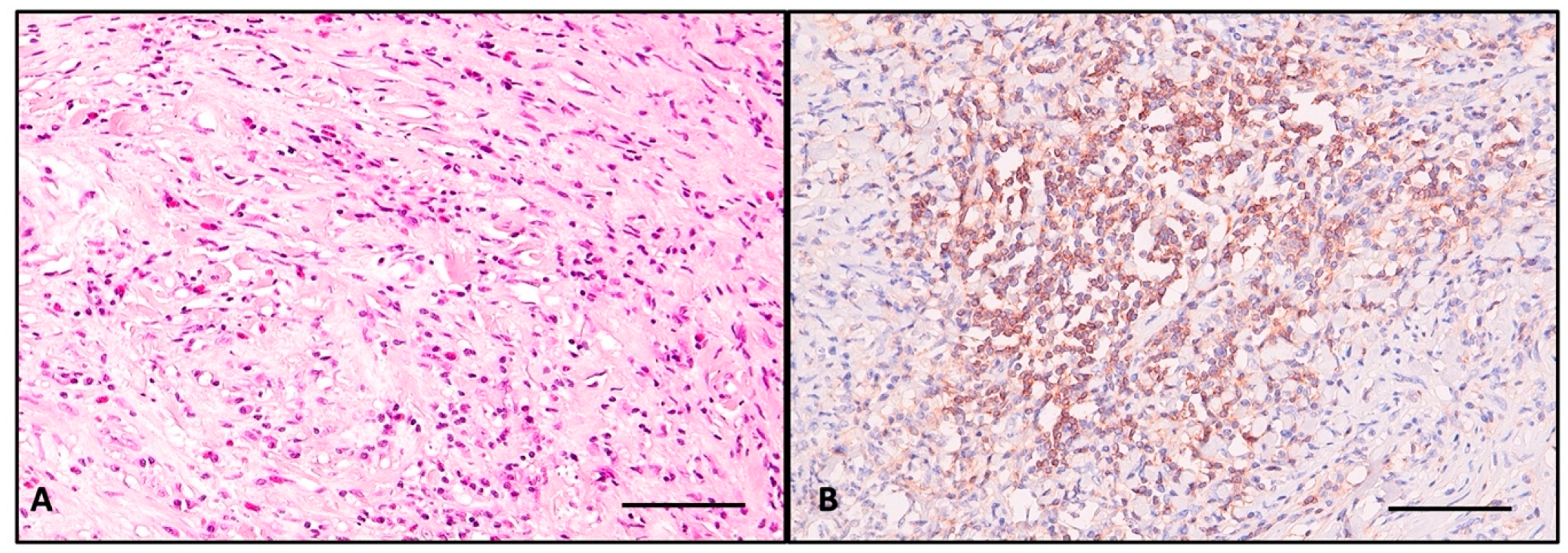 Ijms 26 07786 g004 Ijms 26 07786 g004