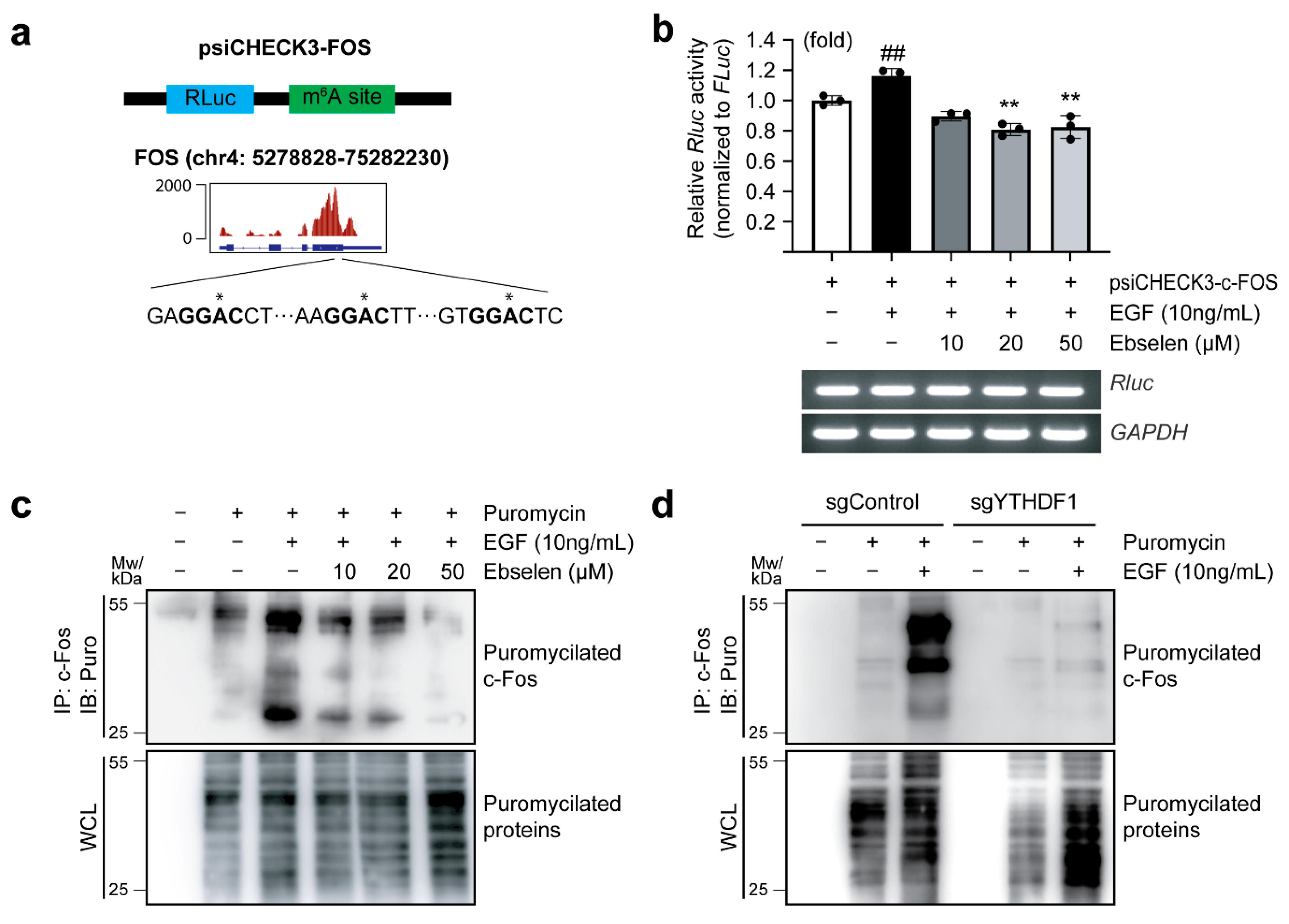 Ijms 26 09416 g004 Ijms 26 09416 g004