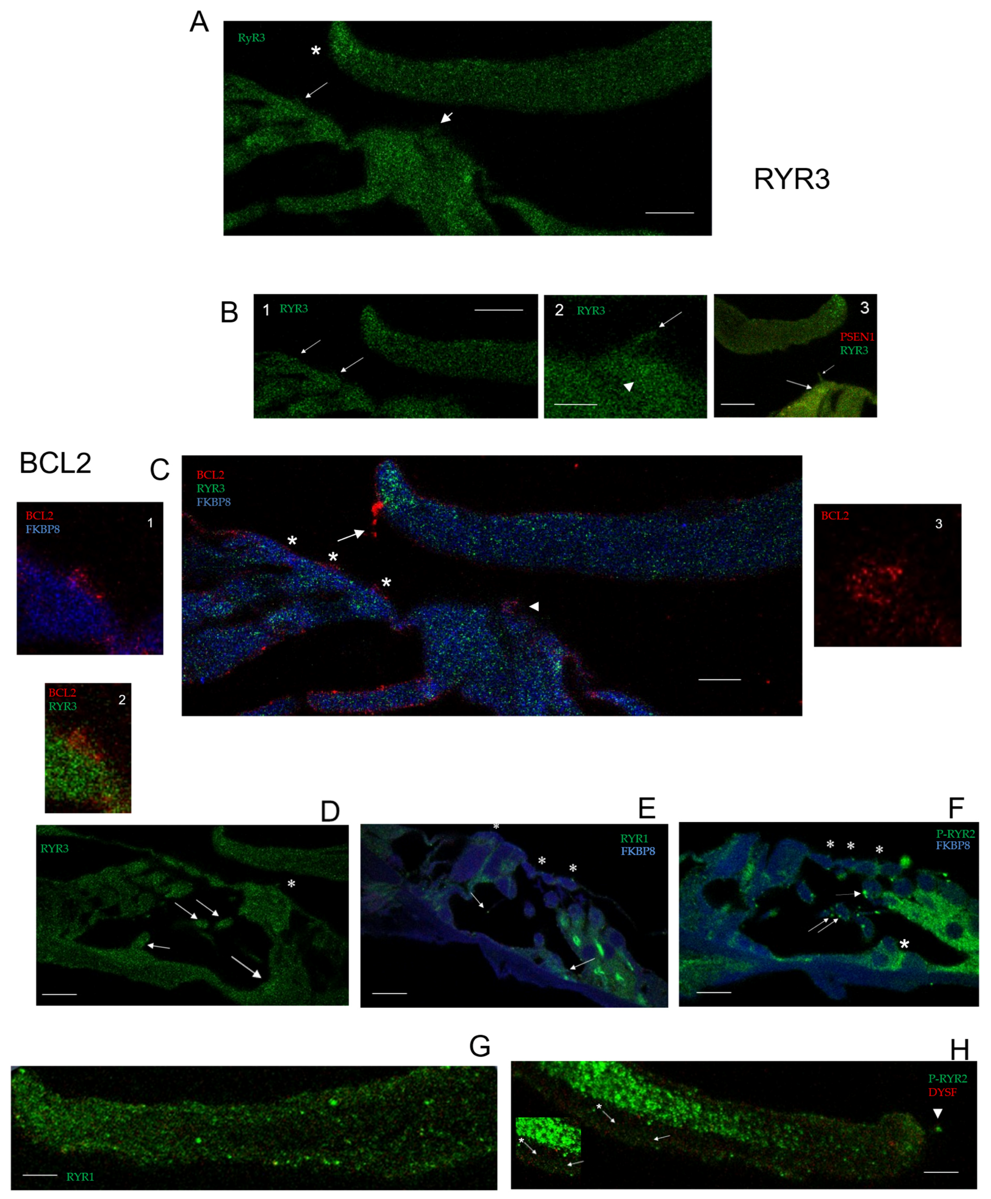 Ijms 26 09559 g002 Ijms 26 09559 g002