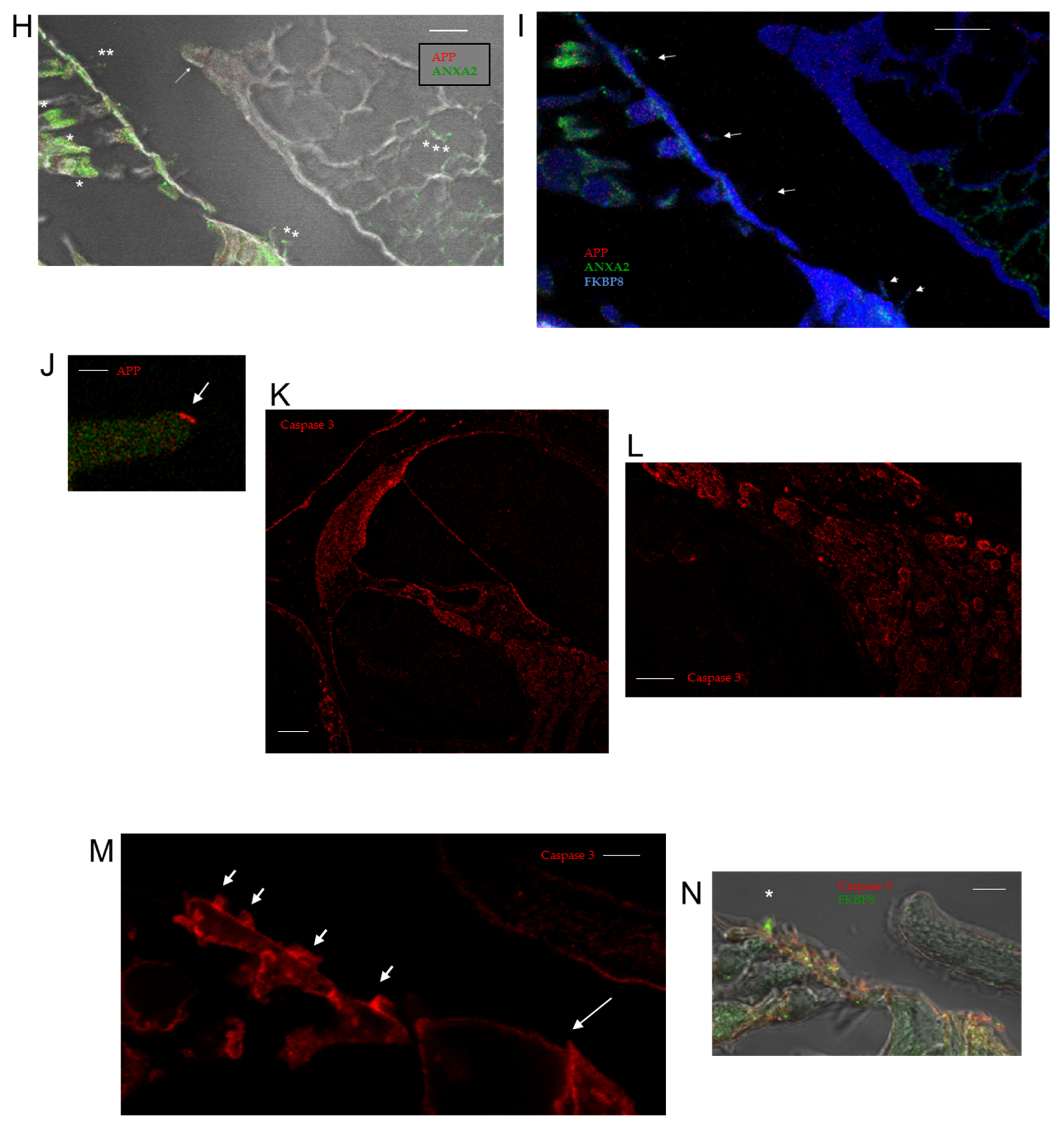 Ijms 26 09559 g005b Ijms 26 09559 g005b