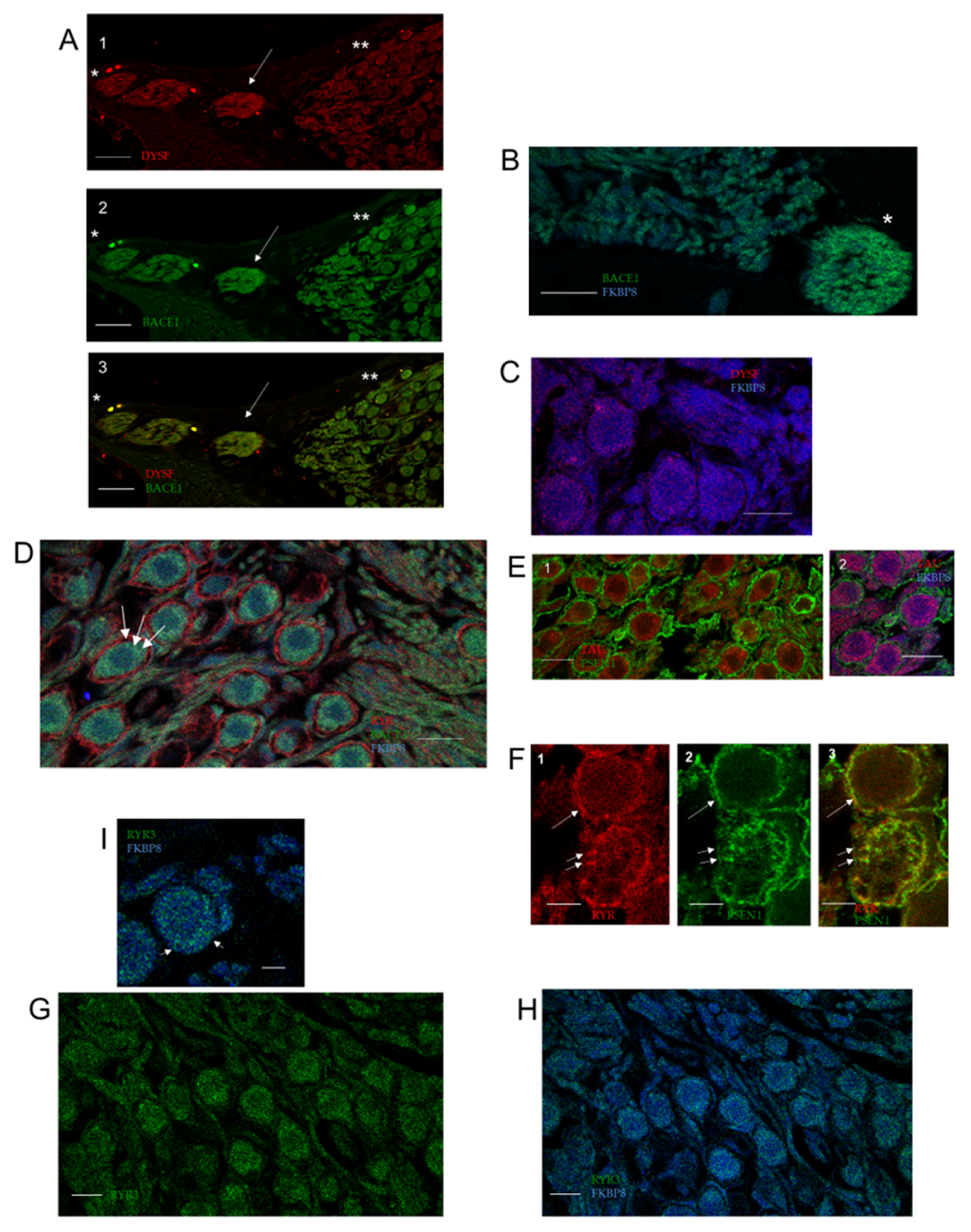 Ijms 26 09559 g006 Ijms 26 09559 g006