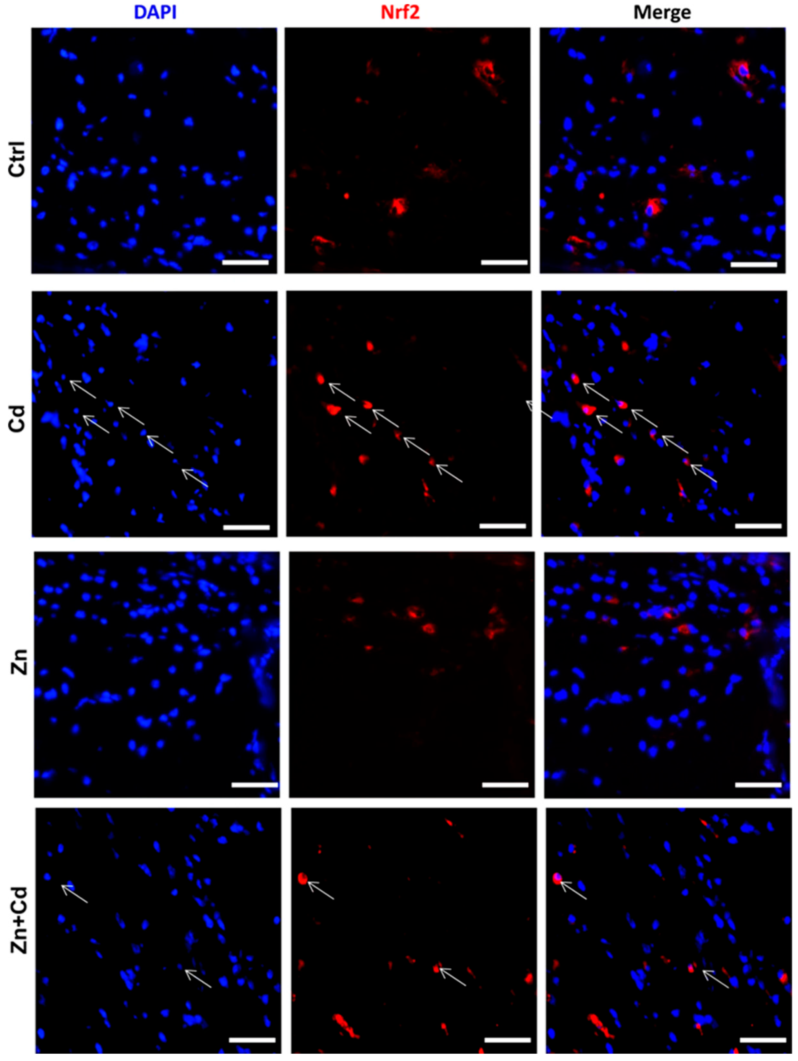Ijms 26 09797 g011 Ijms 26 09797 g011
