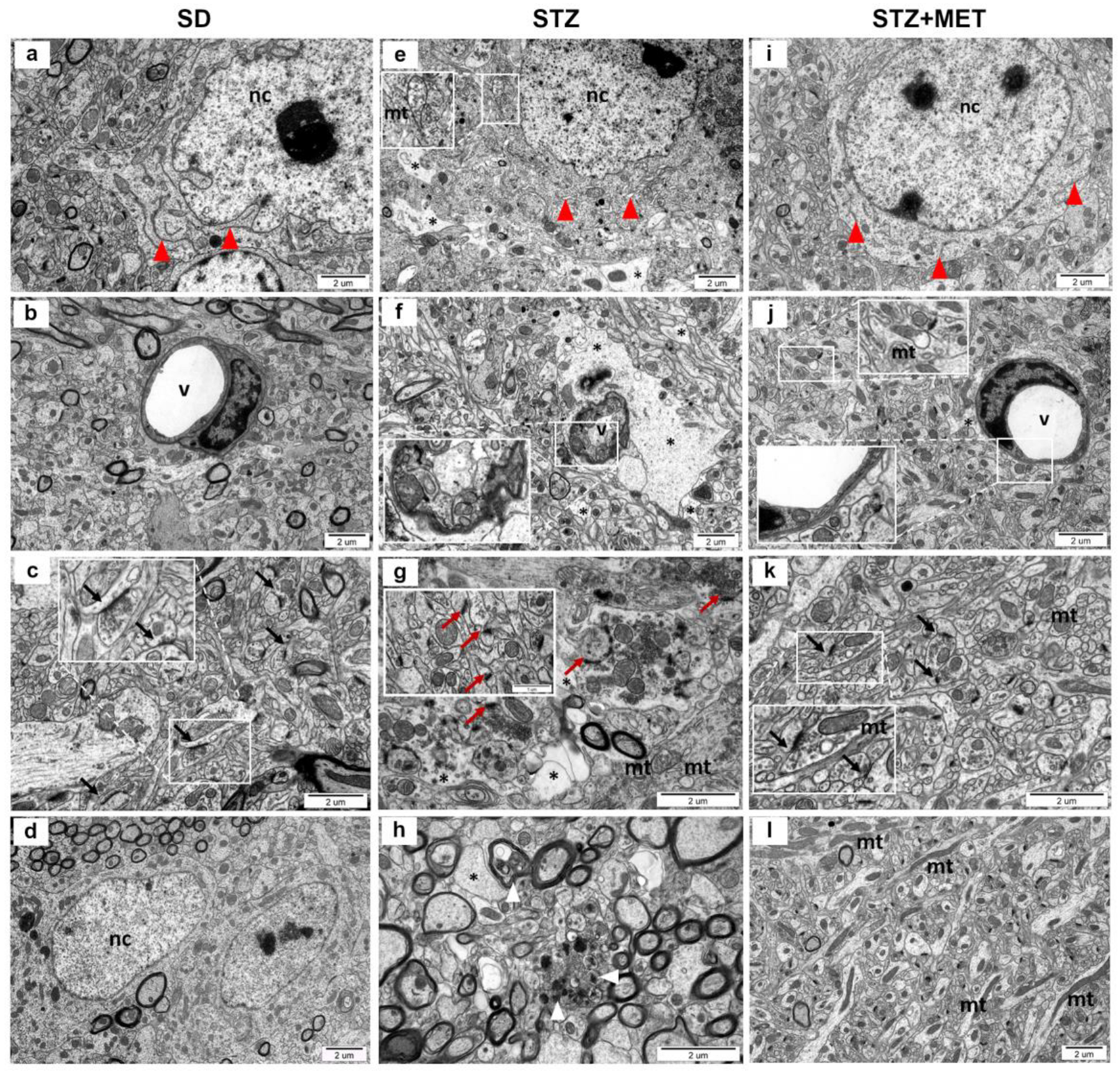 Ijms 26 09832 g004 Ijms 26 09832 g004
