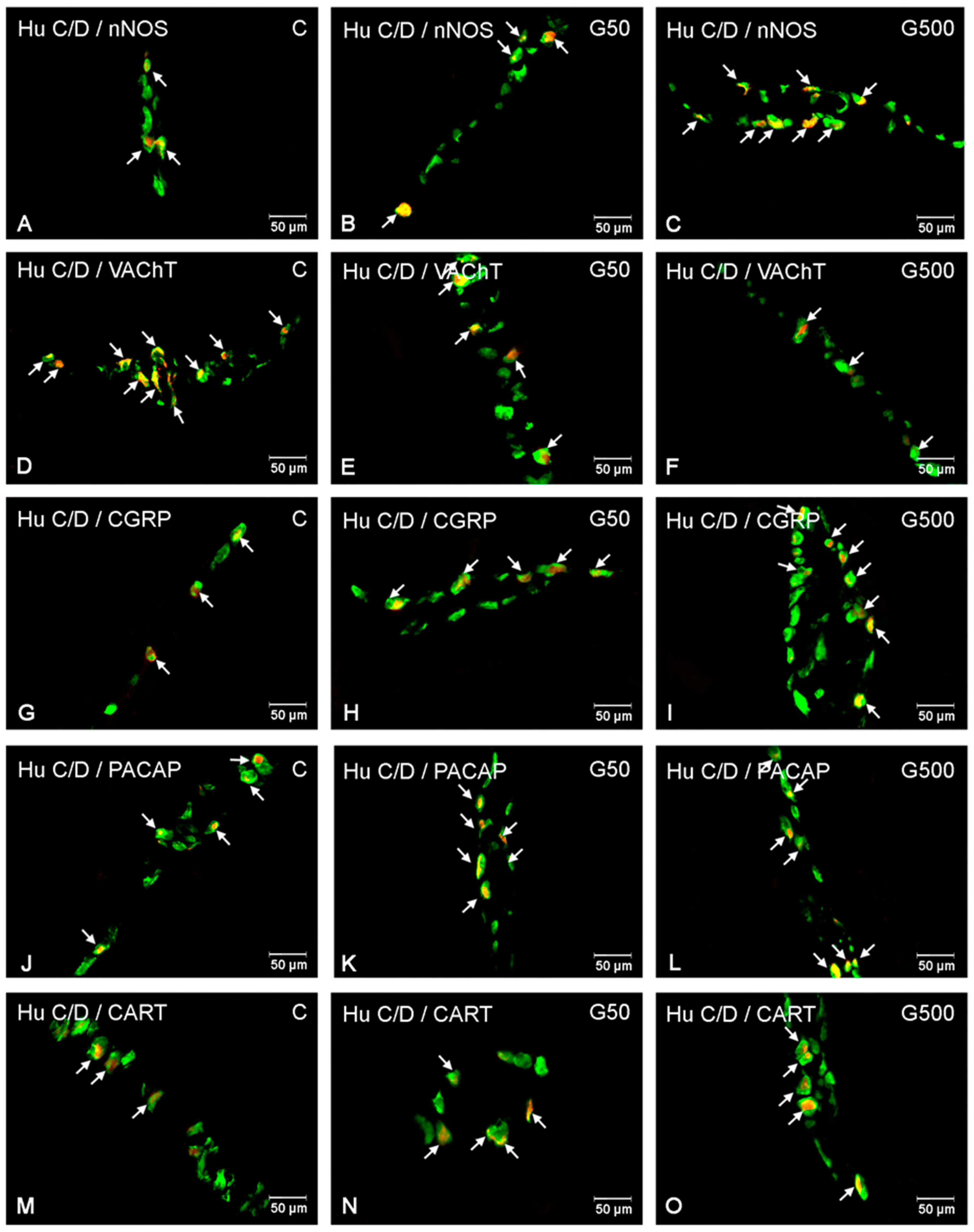 Ijms 26 09840 g003 Ijms 26 09840 g003