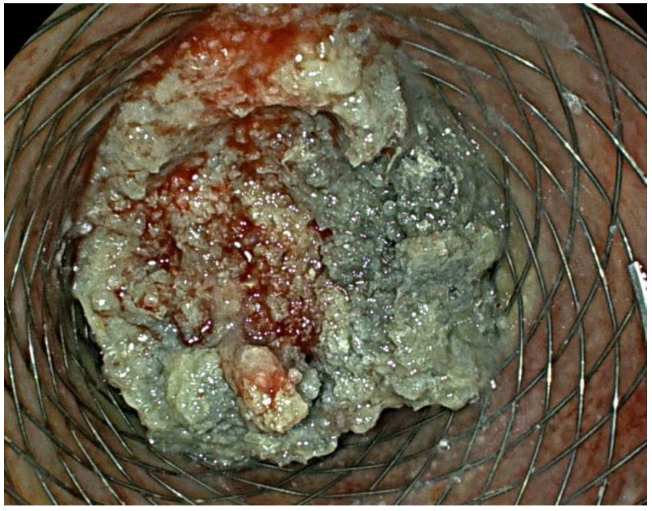 Ijtm 02 00040 g005 Ijtm 02 00040 g005