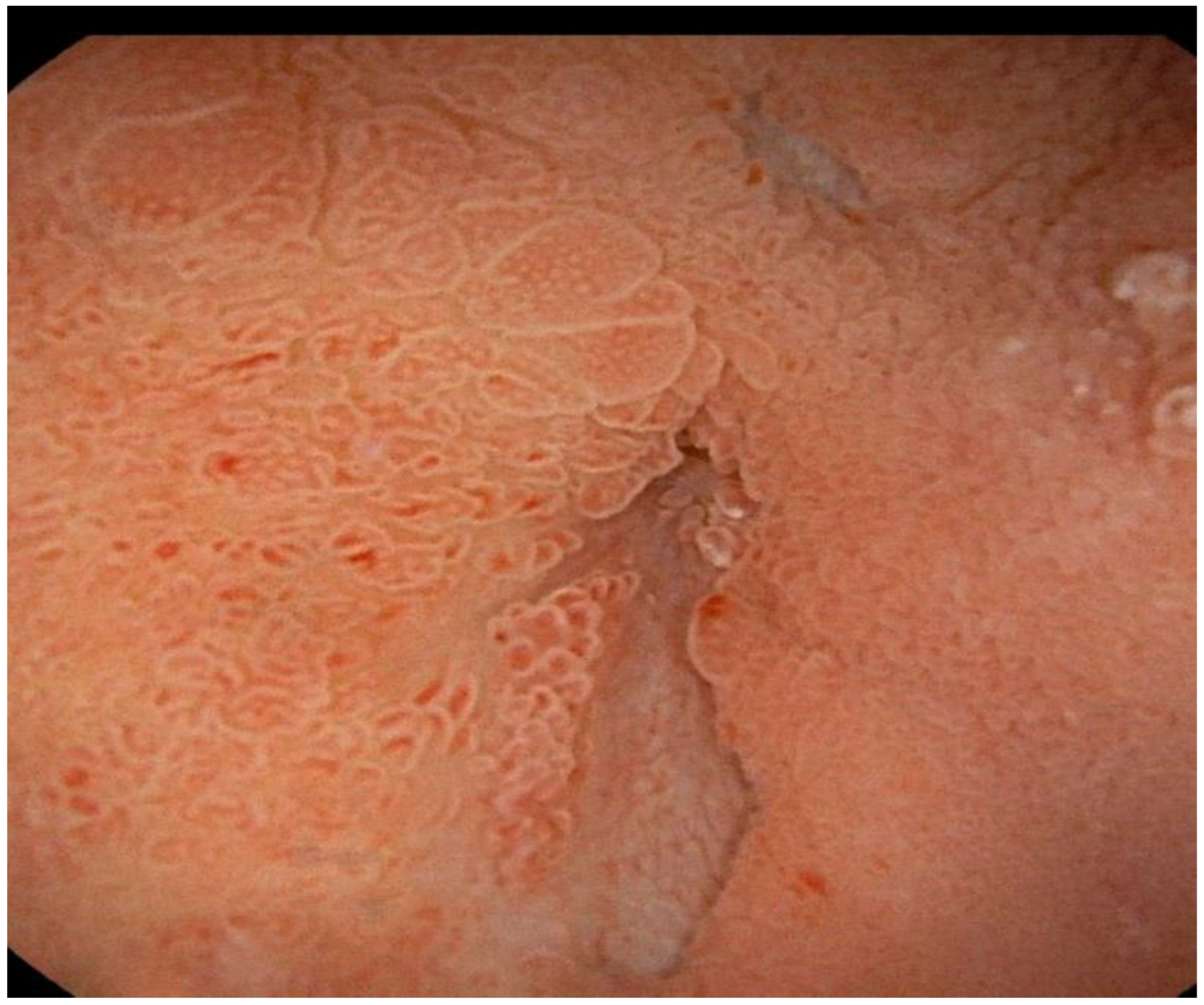 Ijtm 02 00040 g008 Ijtm 02 00040 g008