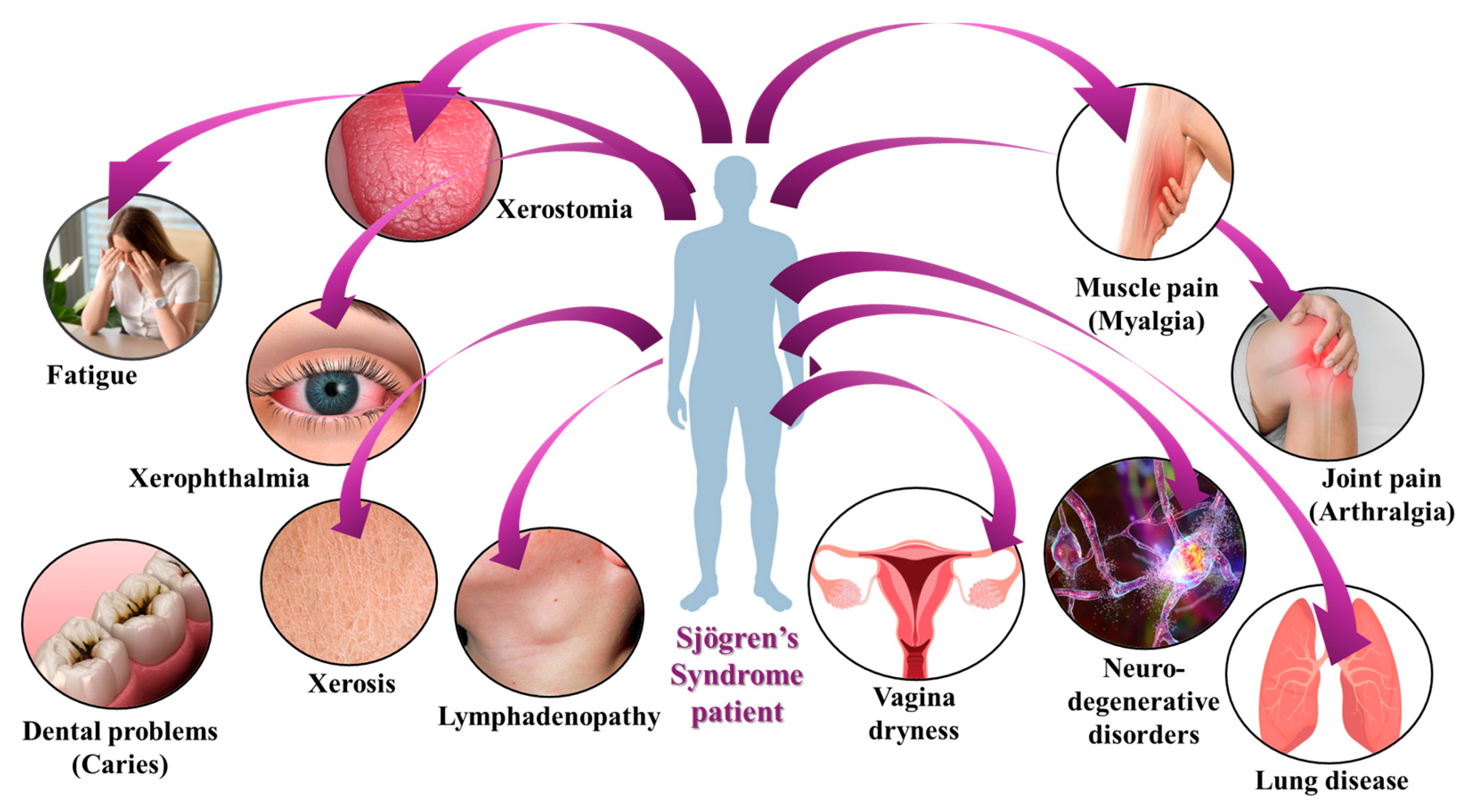 Immuno 05 00024 g005 Immuno 05 00024 g005