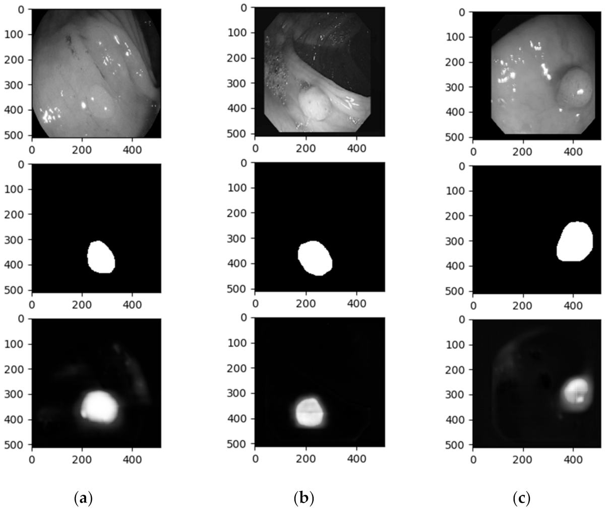 Information Free Full Text Deep Learning Models For Colorectal Polyps 3110