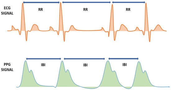 Information | Free Full-Text | Non-Invasive Classification of Blood ...