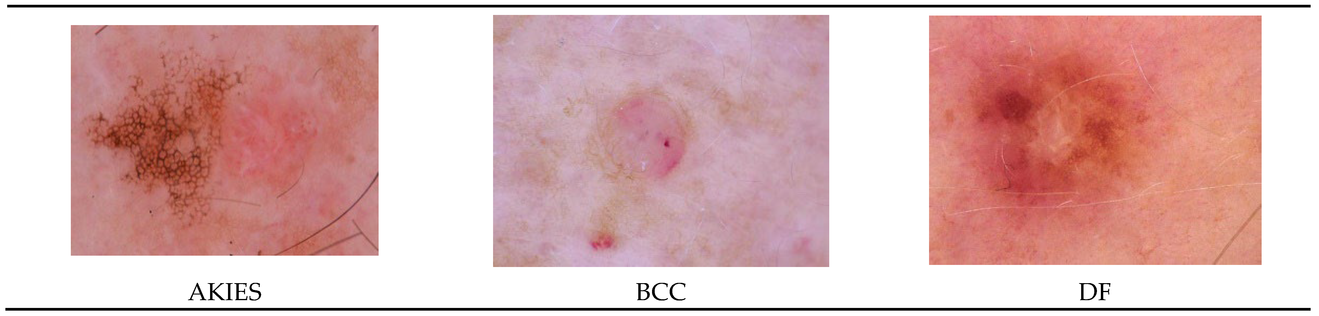 Information Free Full Text Multi Class Skin Cancer Classification Using Vision Transformer