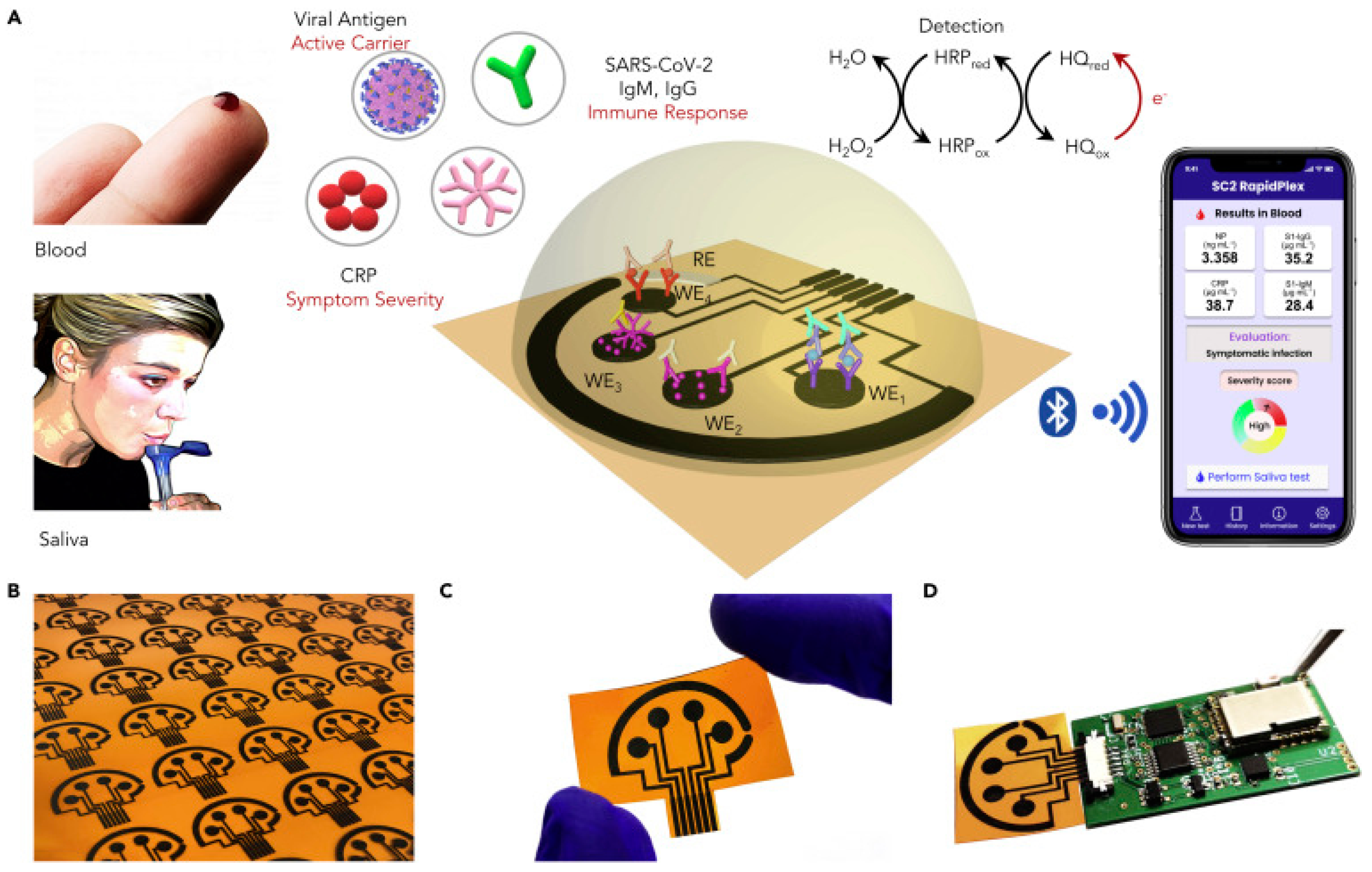 Inorganics Free Full Text Graphene Based Electrochemical Nano Biosensors For Detection Of