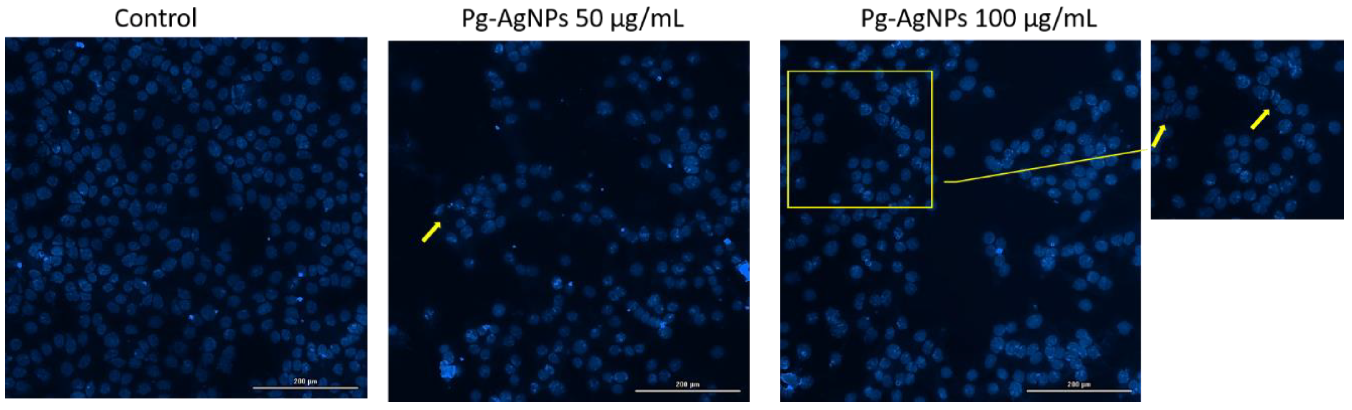Inorganics 12 00160 g010