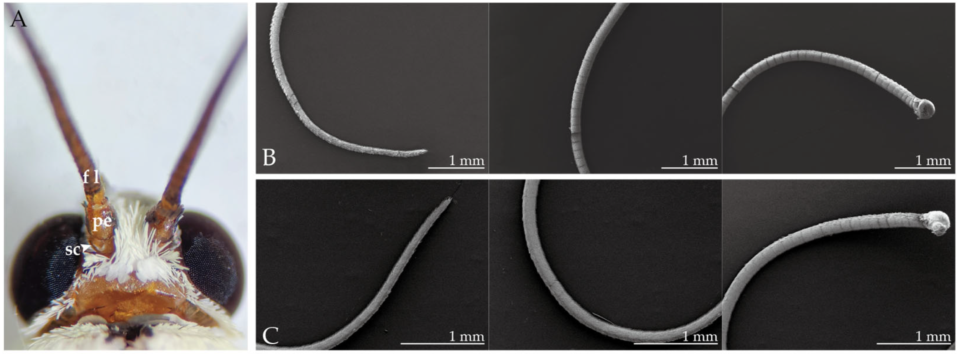 Insects | Free Full-Text | Ultrastructural and Descriptive Study on the ...