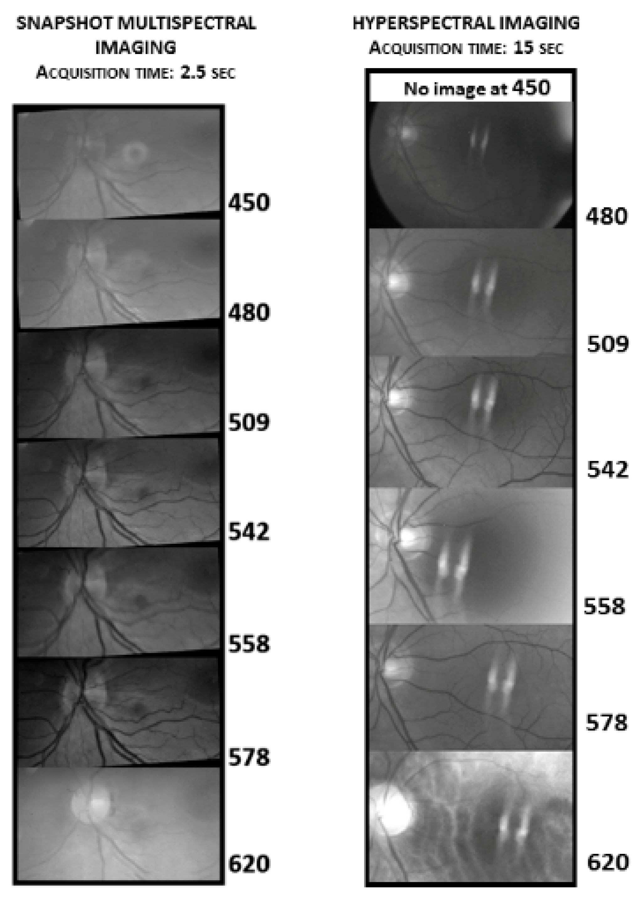 Instruments Free Full Text Functional Imaging Of The Ocular Fundus Using An 8 Band Retinal Multispectral Imaging System Html