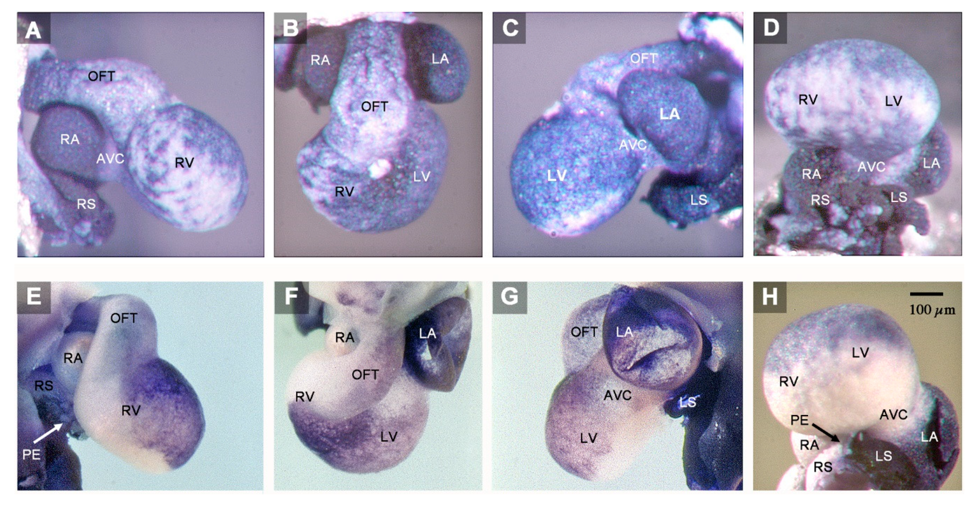 y w eyFLP; FRT 42D embryos and dcr-2 L811fsX ; P[w + , DCR-2] embryos