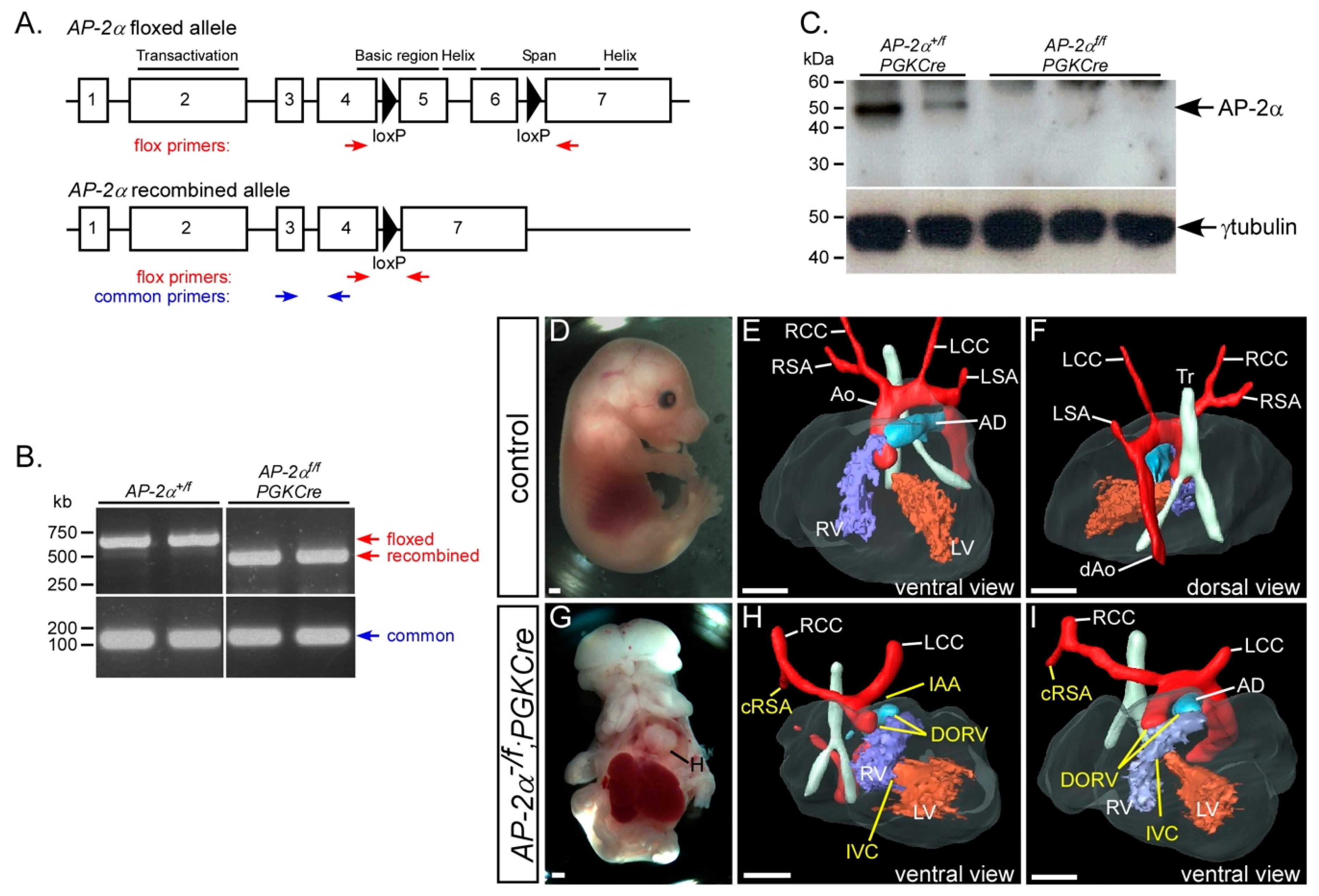 Jcdd Free Full Text Early Embryonic Expression Of Ap 2a Is Critical For Cardiovascular Development Html