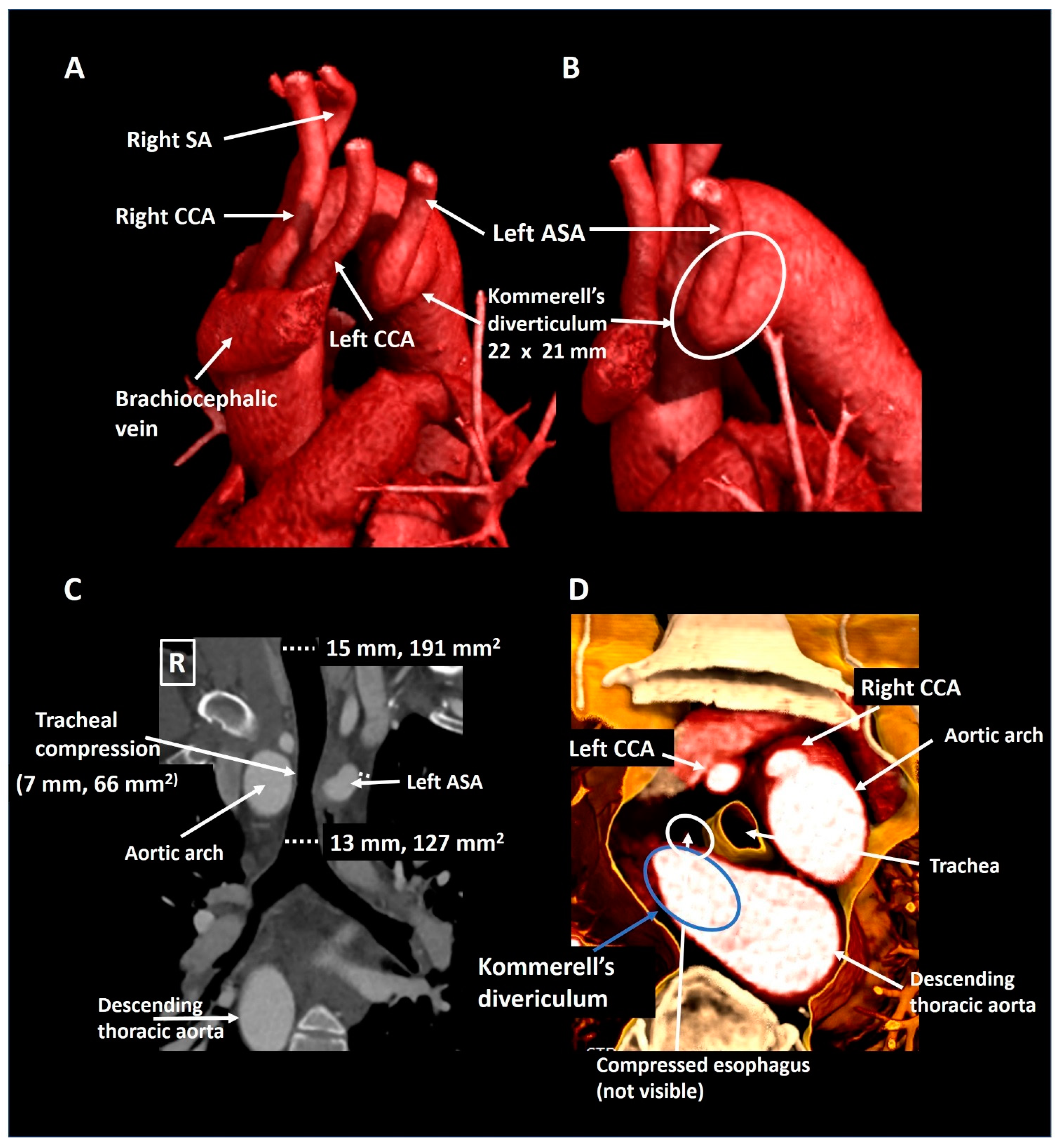 Jcdd 08 00025 g004 Jcdd 08 00025 g004