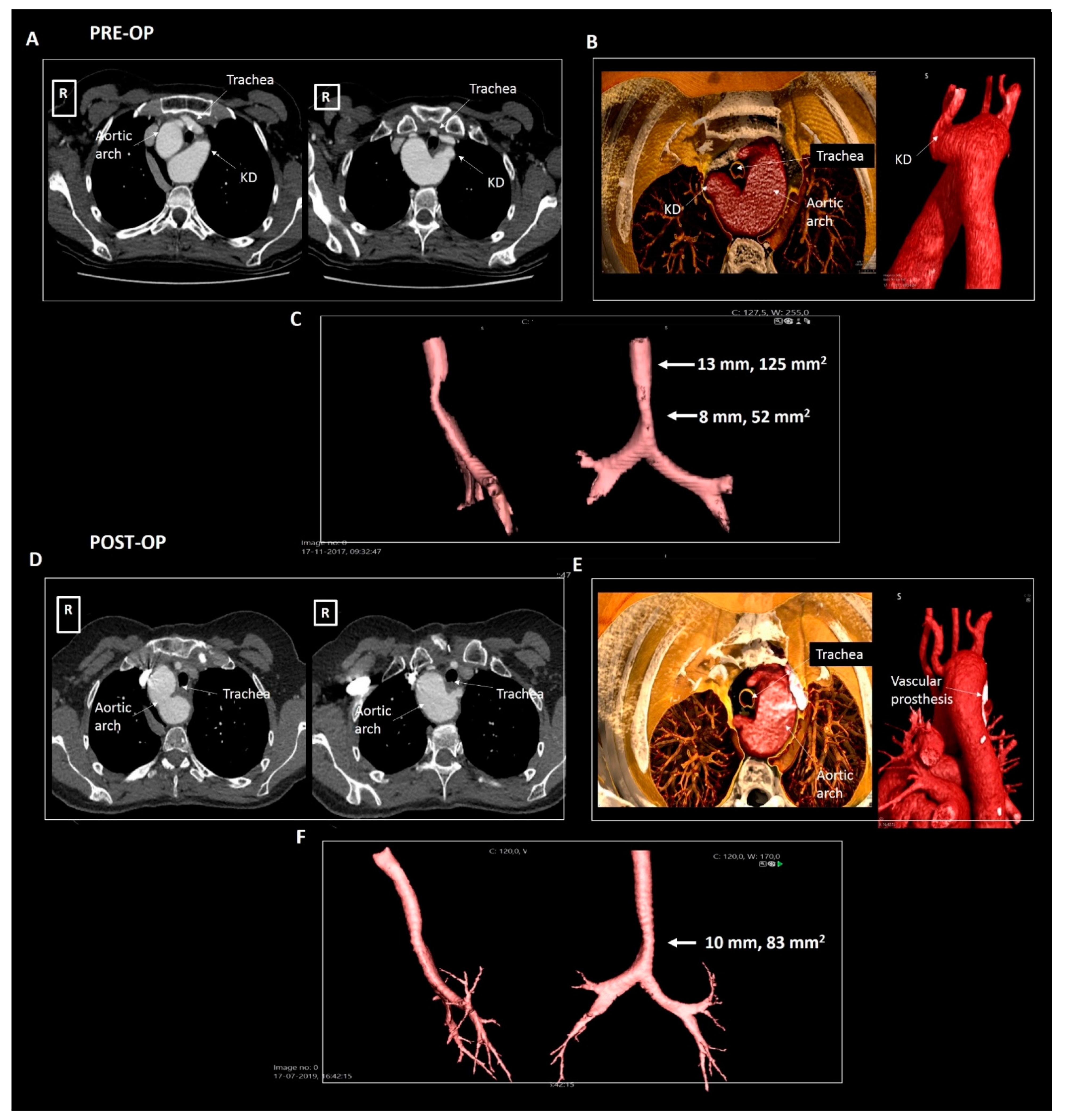 Jcdd 08 00025 g005 Jcdd 08 00025 g005