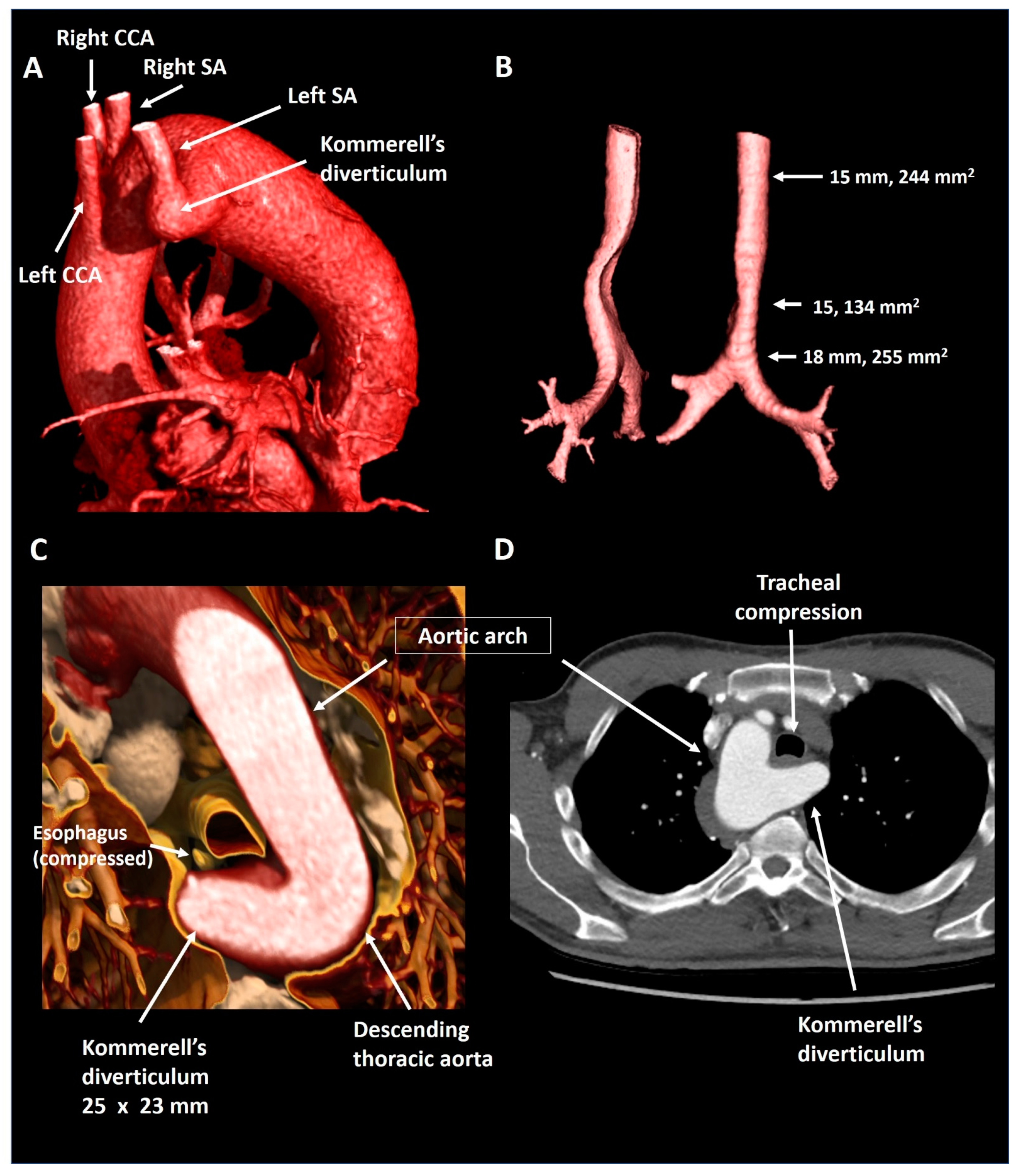 Jcdd 08 00025 g006 Jcdd 08 00025 g006