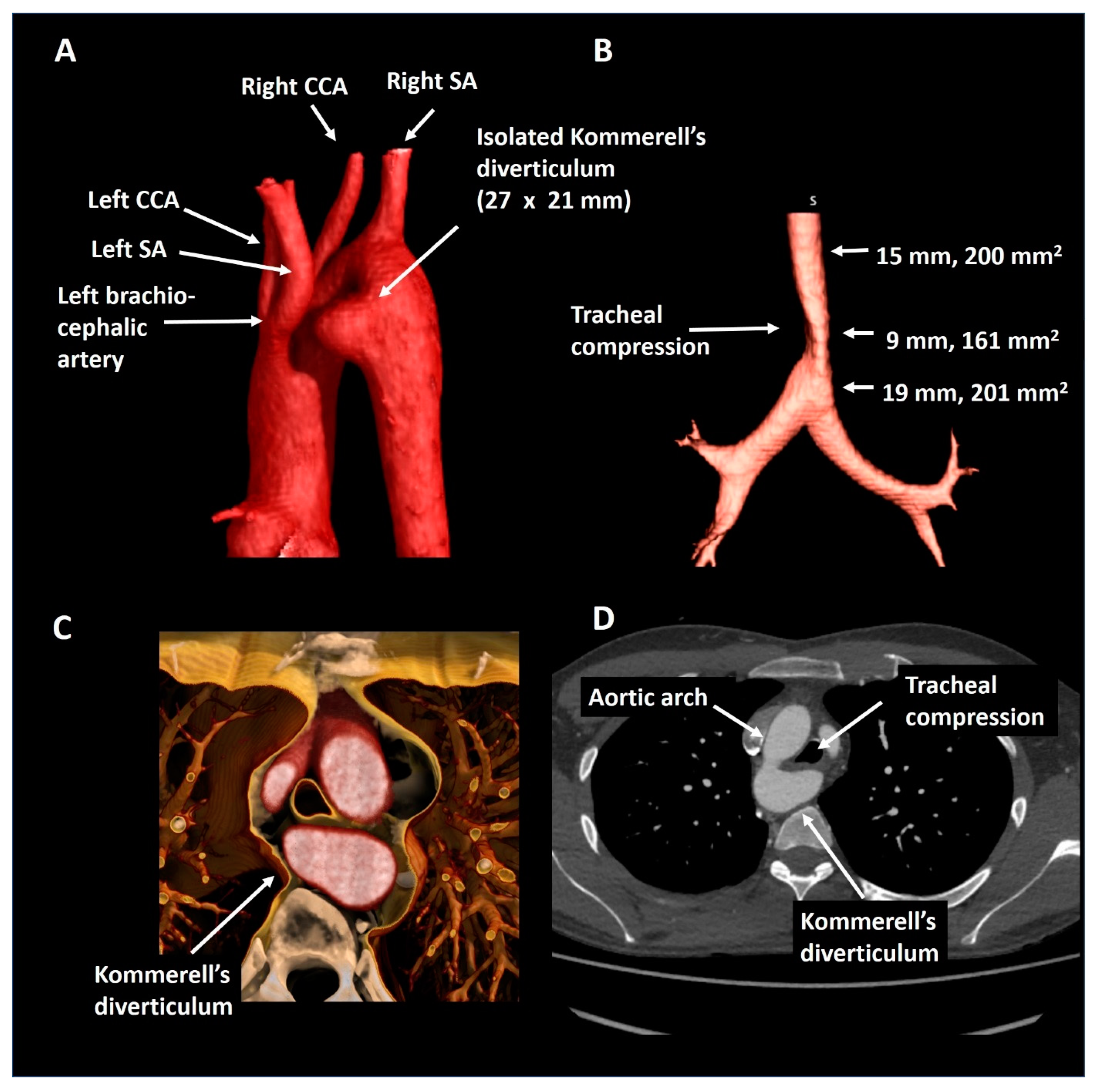 Jcdd 08 00025 g008 Jcdd 08 00025 g008