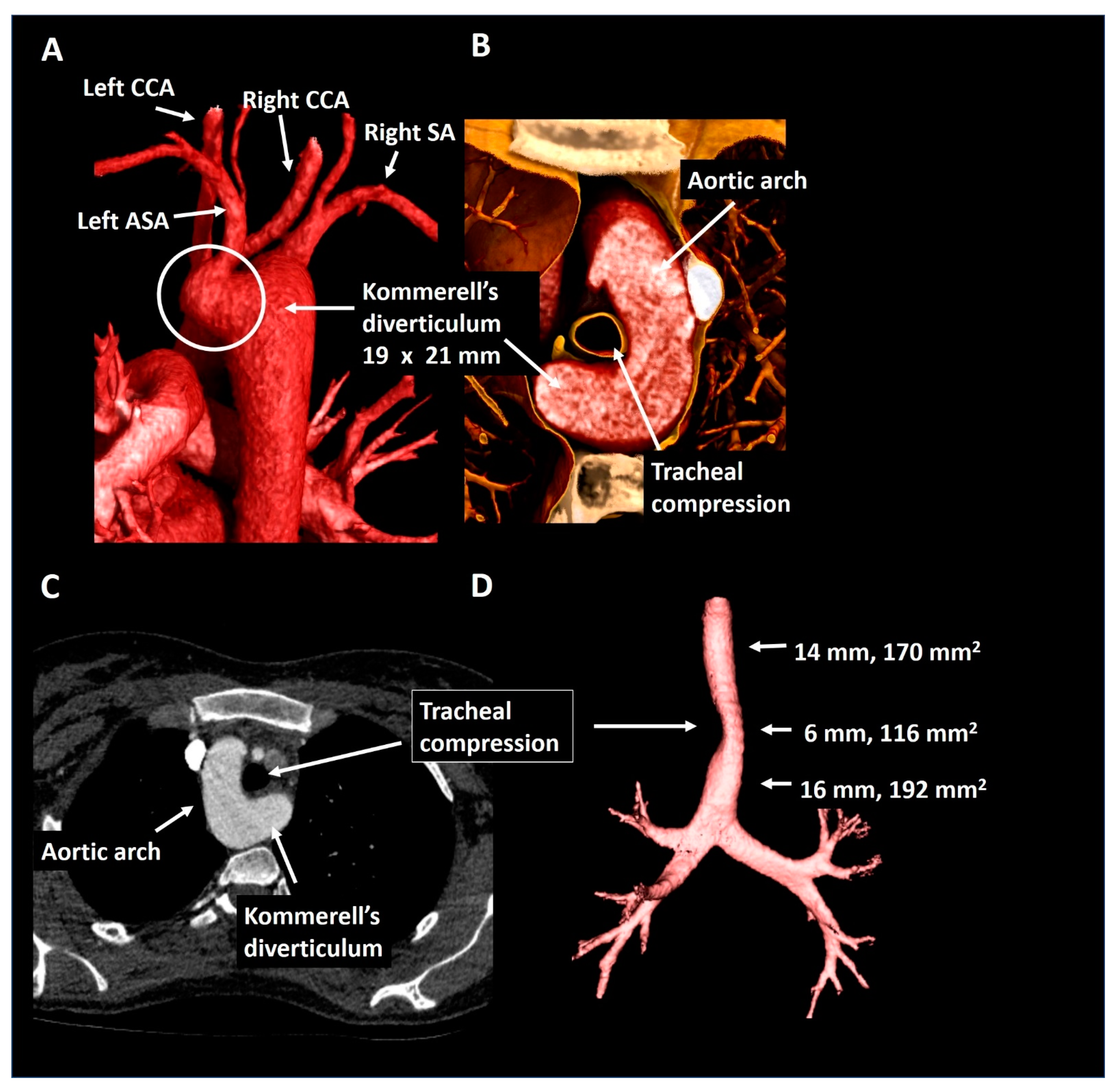 Jcdd 08 00025 g009 Jcdd 08 00025 g009