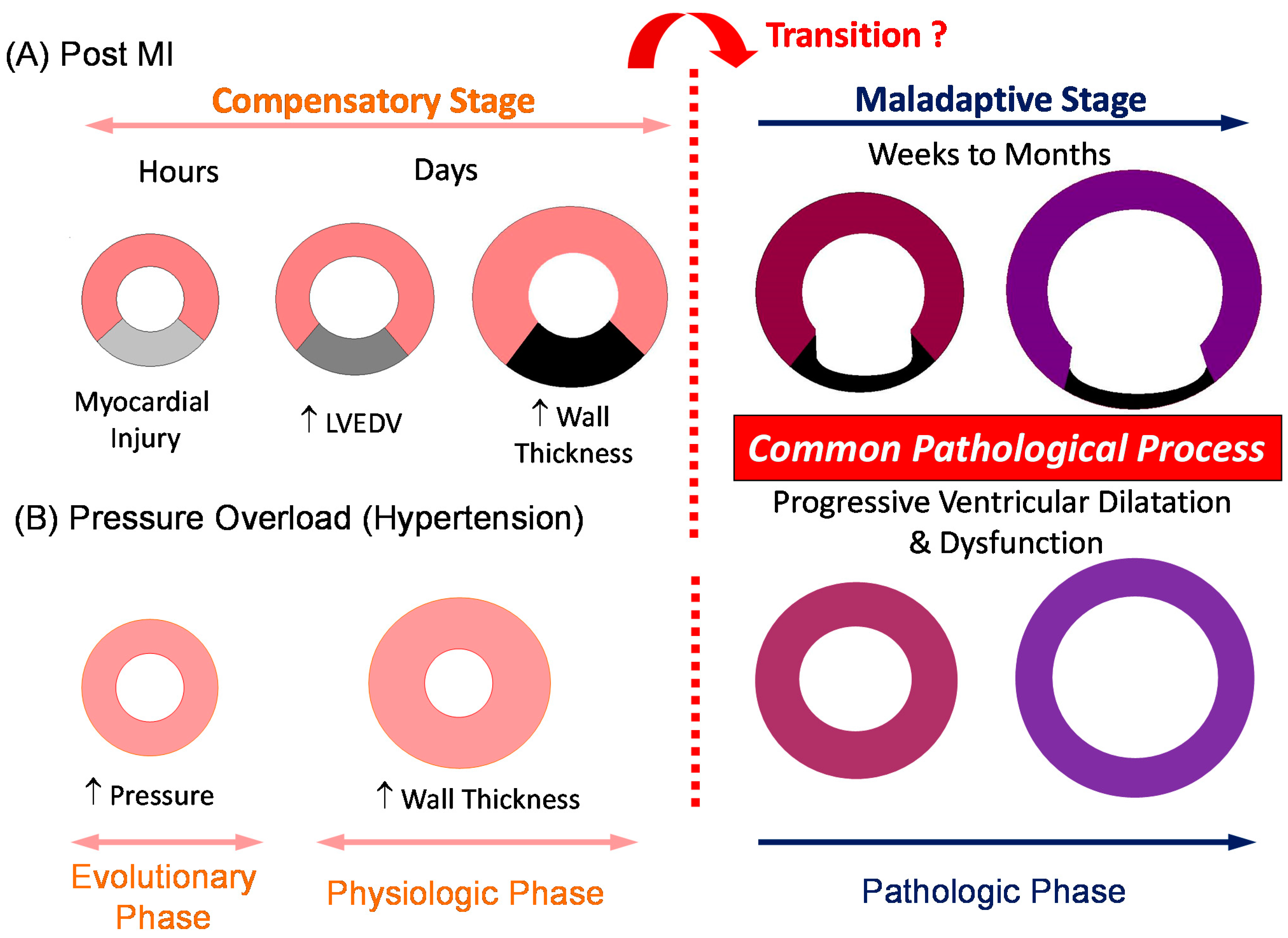 Progression of Left Ventricular Myocardial Dysfunction in Systemic