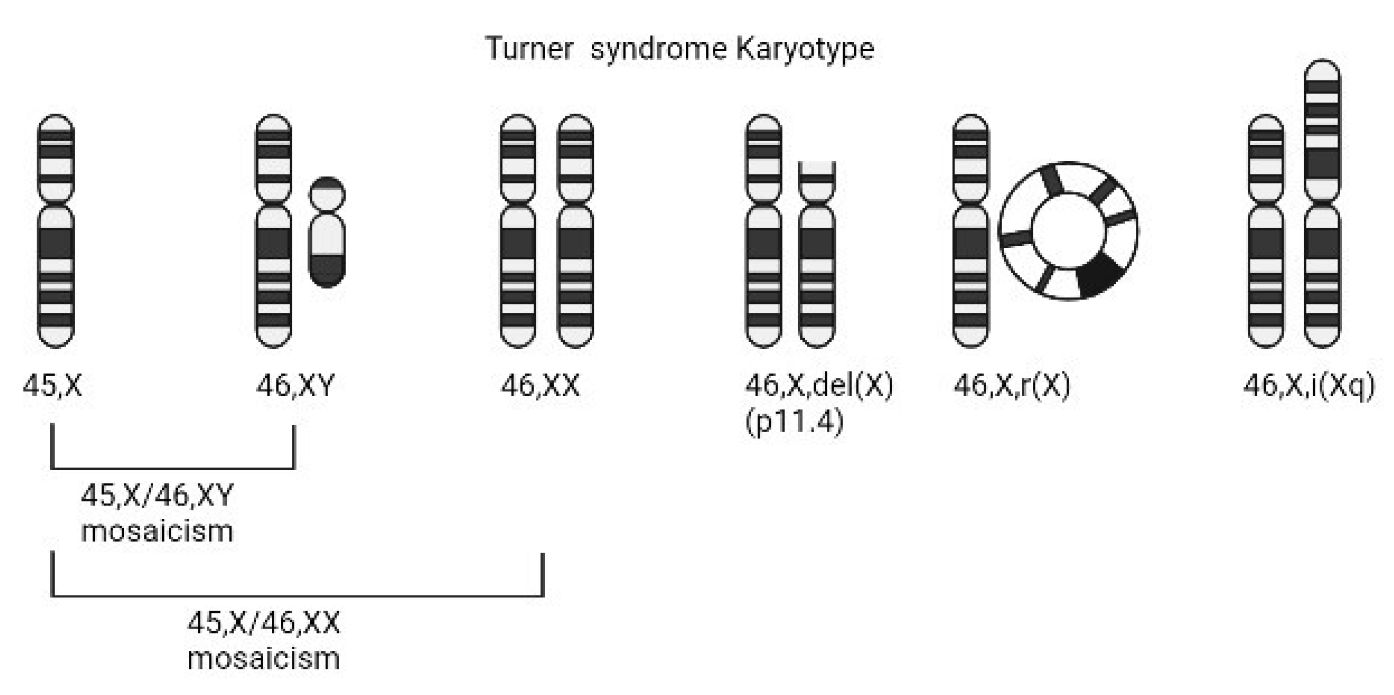 JCDD | Free Full-Text | A Review of Recent Developments in Turner Syndrome  Research | HTML