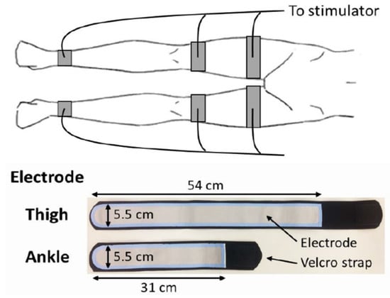 58: How to Use Electric Muscle Stimulation to Treat MS