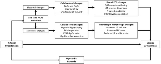 JCDD | Free Full-Text | Hypertension and Arrhythmias: A Clinical Overview  of the Pathophysiology-Driven Management of Cardiac Arrhythmias in  Hypertensive Patients