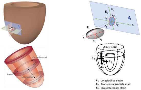 JCDD | Free Full-Text | Geometry Does Impact on the Plane Strain