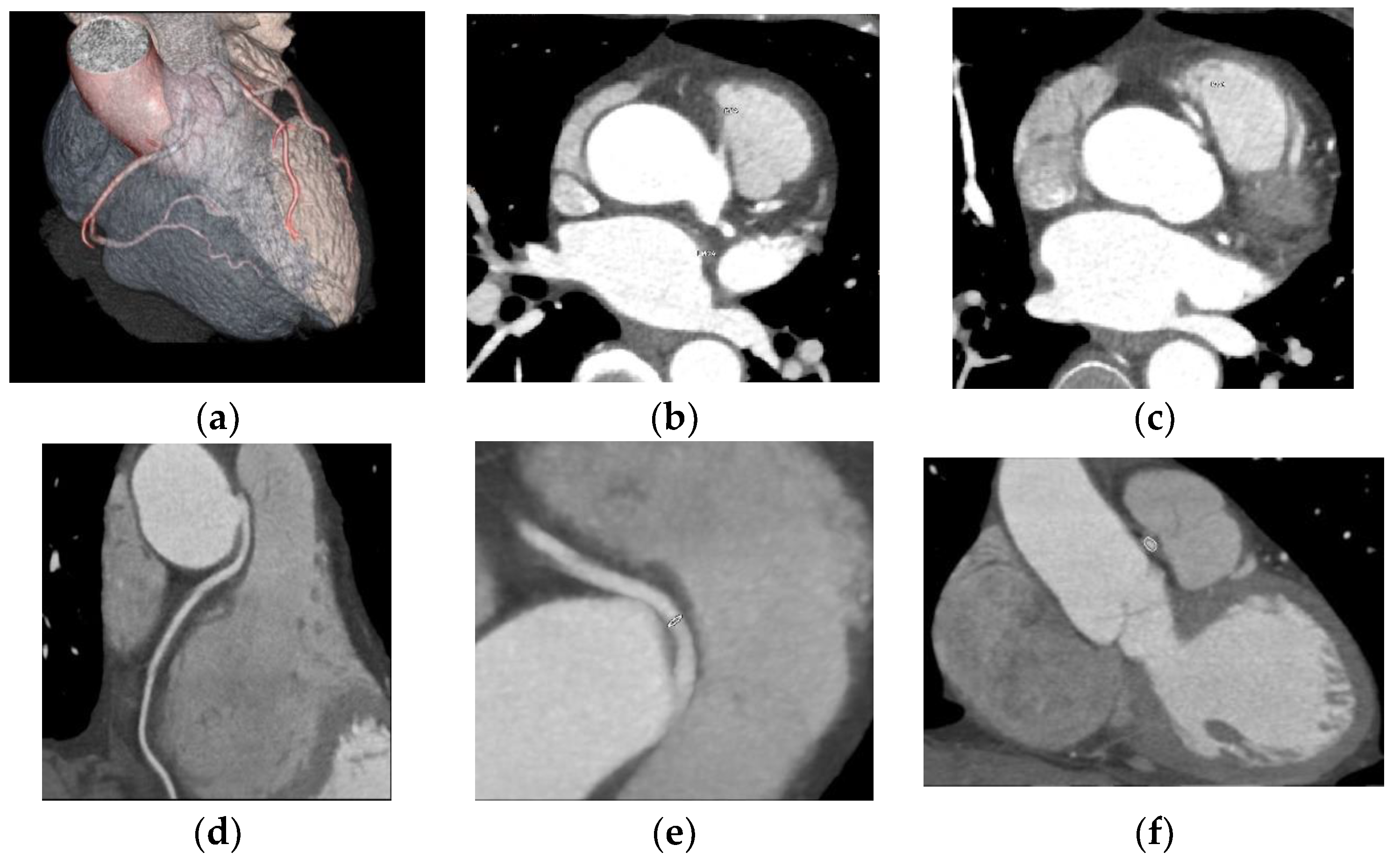 Jcdd Free Full Text A Pilot Study On The Role Of Computed Tomography In The Management Of