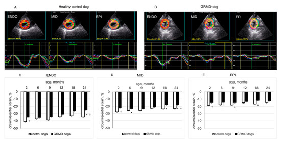 Left ventricular global strains by linear measurements in three