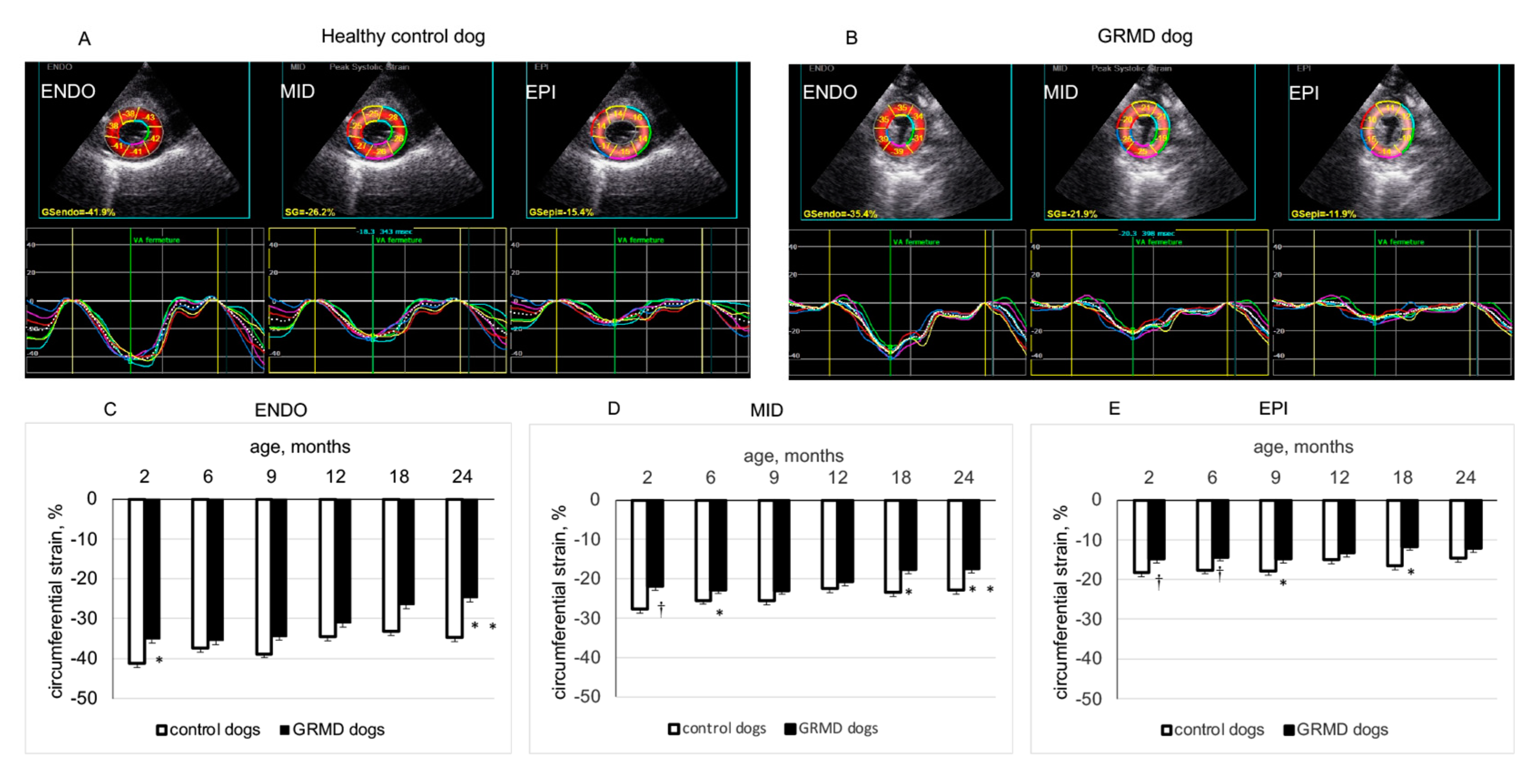 A Test in Context: Myocardial Strain Measured by Speckle-Tracking