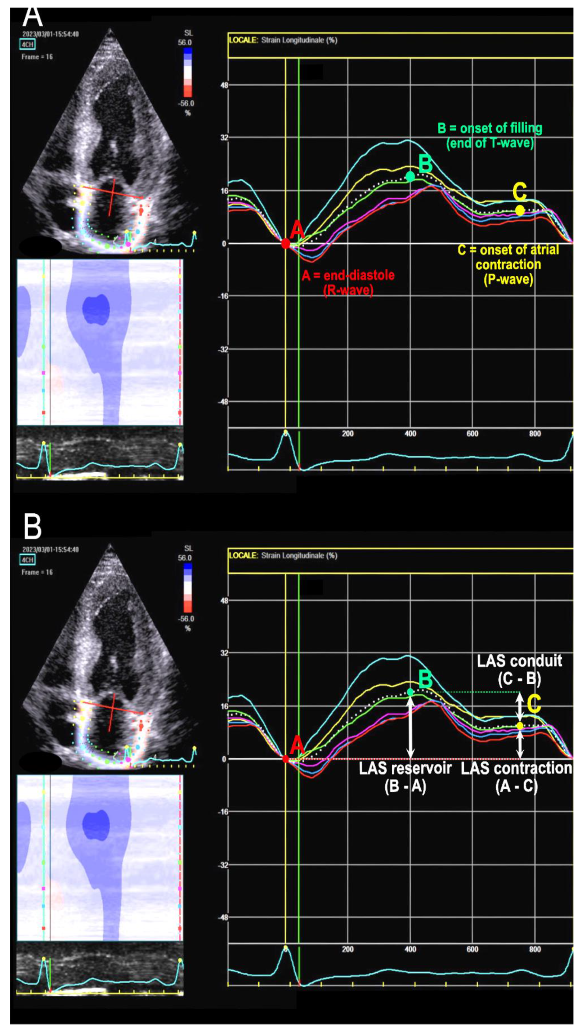 A Test in Context: Myocardial Strain Measured by Speckle-Tracking  Echocardiography - ScienceDirect