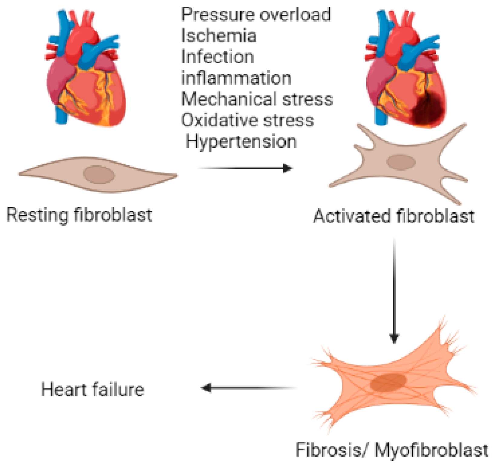 Reversible cardiac dysfunction in long-standing hypertension may be global  variant of stress cardiomyopathy