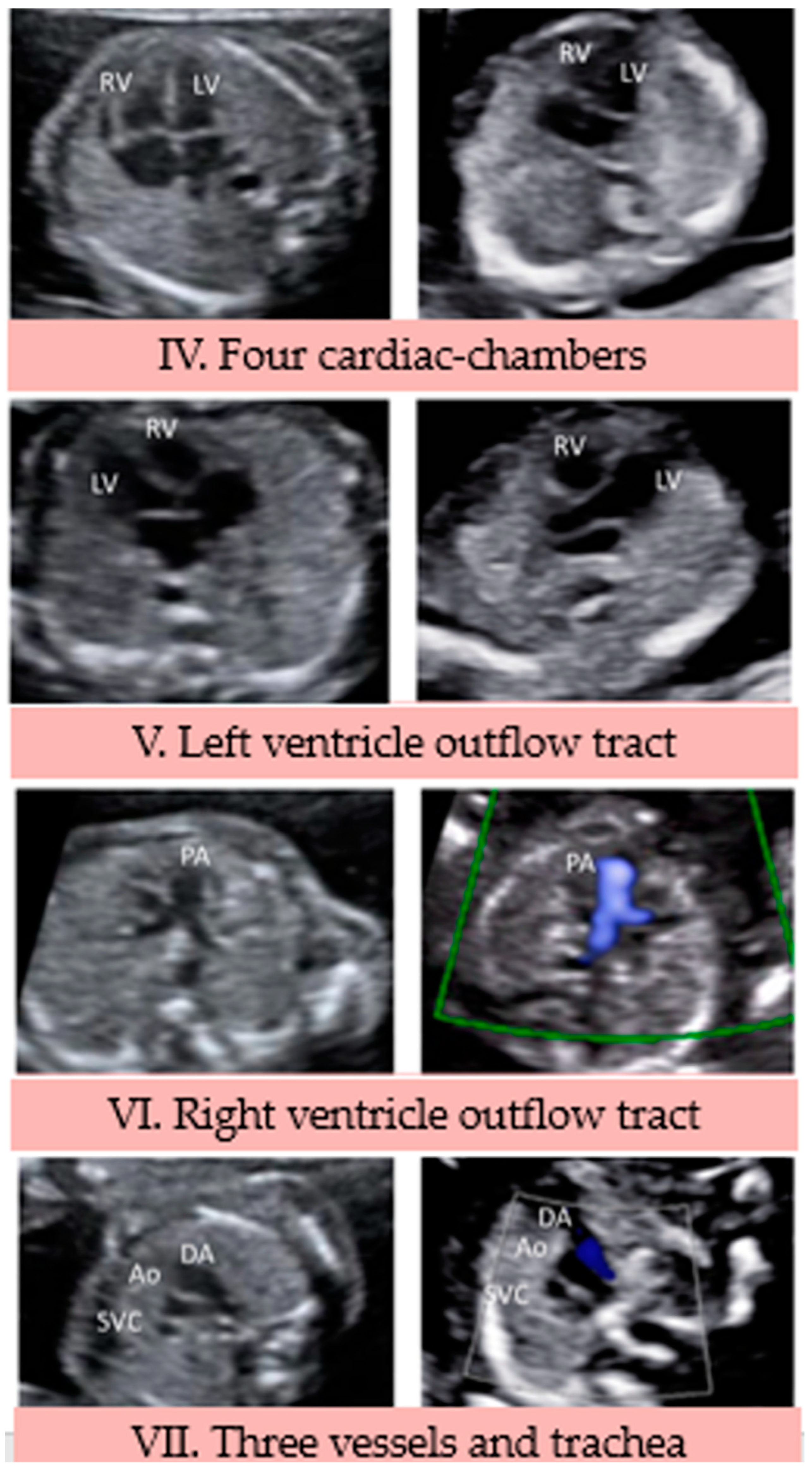 Jcdd 10 00340 g003 Jcdd 10 00340 g003