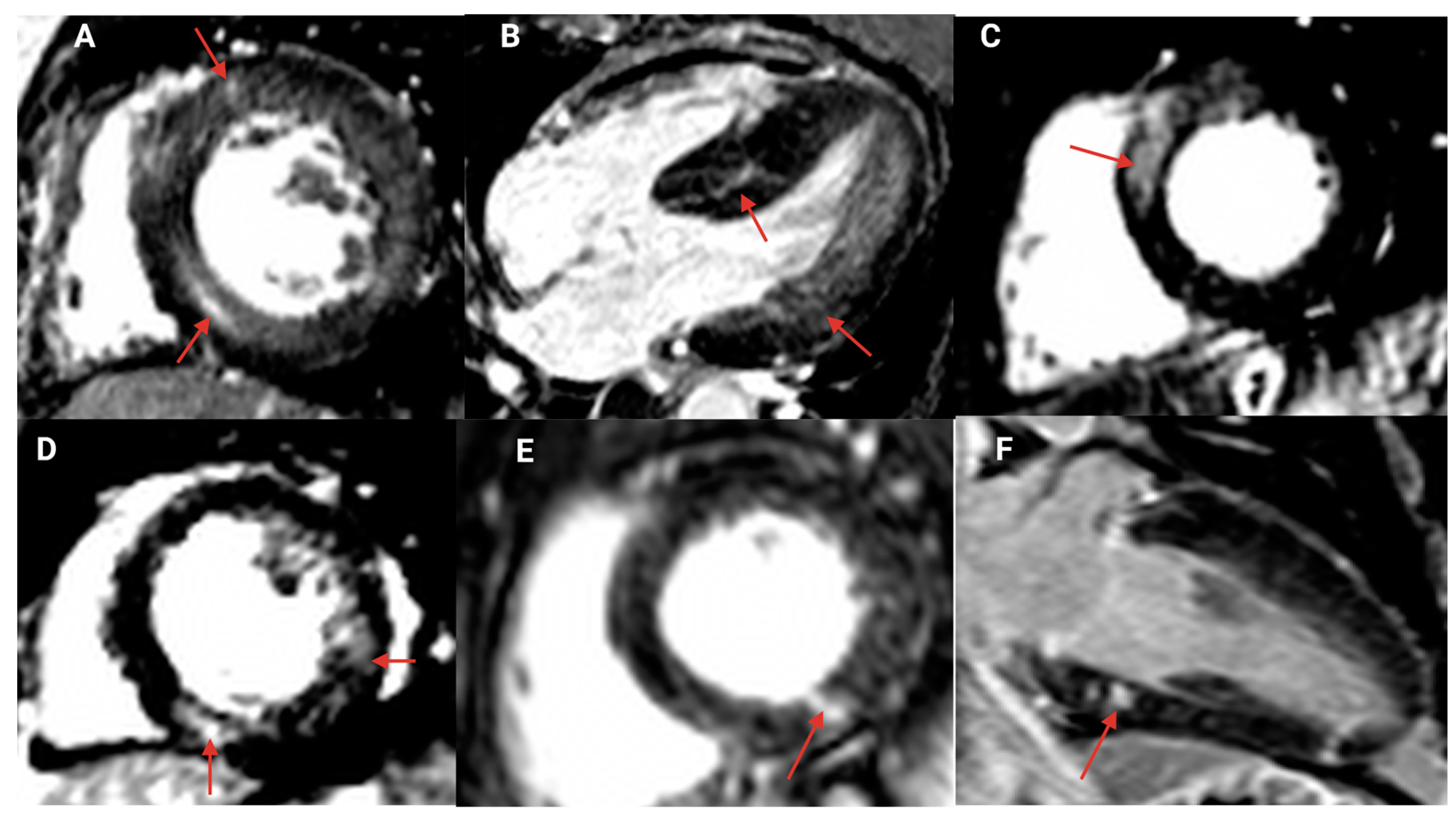 JCDD | Free Full-Text | Cardiac Morphology, Function, And Left ...