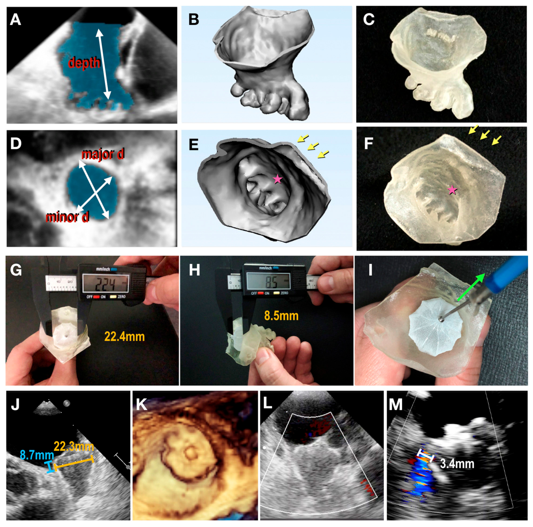 Jcdd 11 00022 g012 Jcdd 11 00022 g012